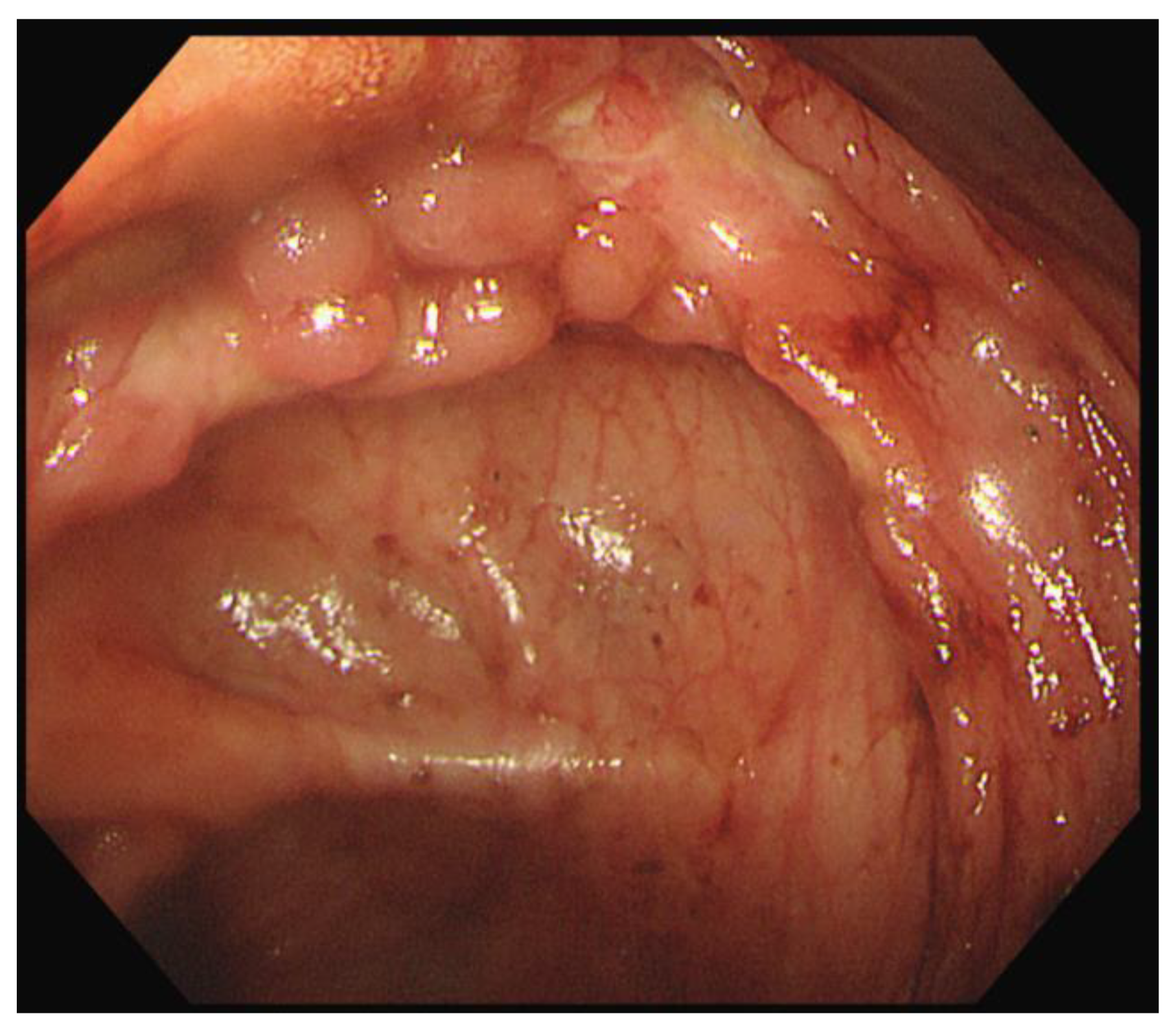 Children 09 01663 g003 Children 09 01663 g003