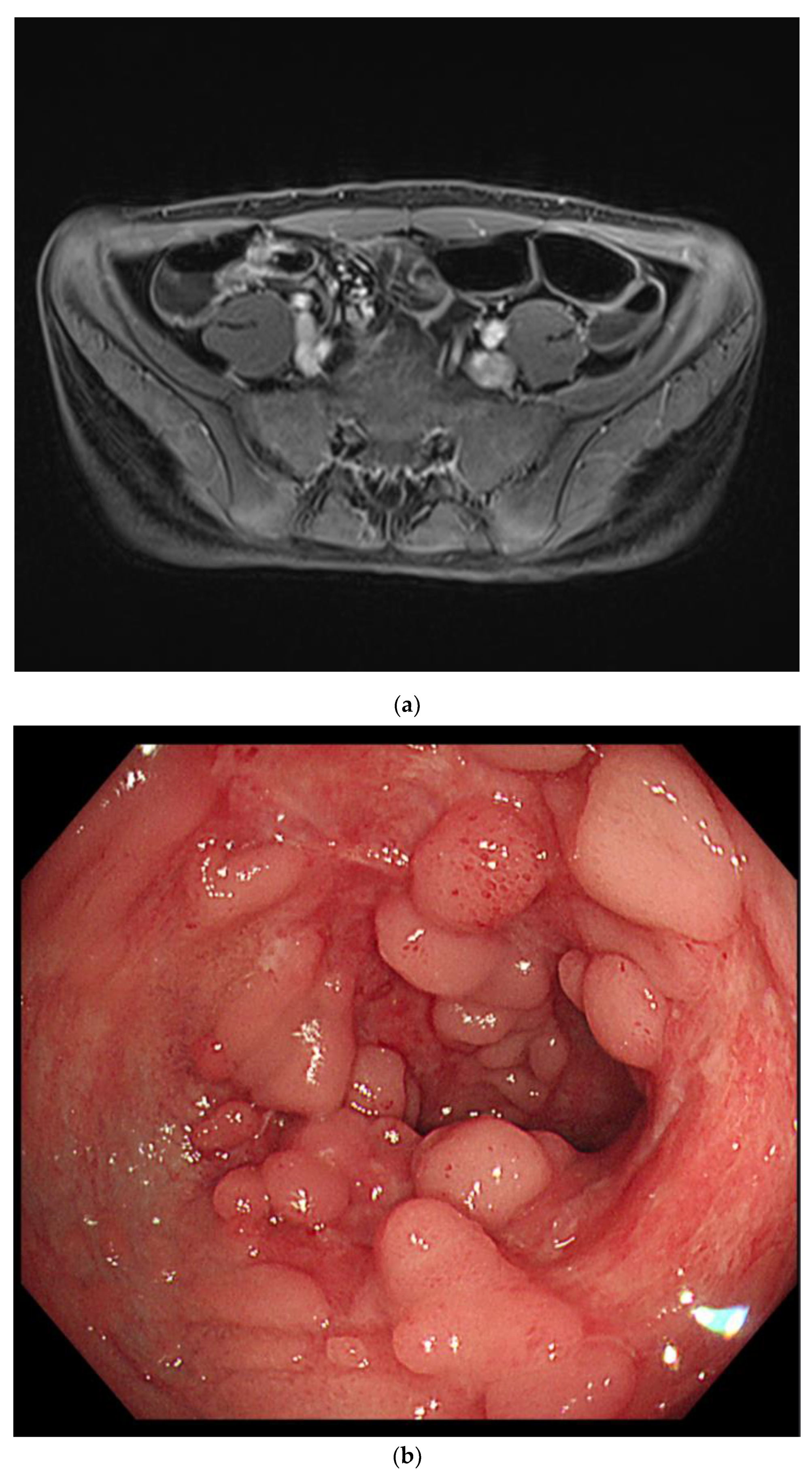 Children 09 01663 g004 Children 09 01663 g004