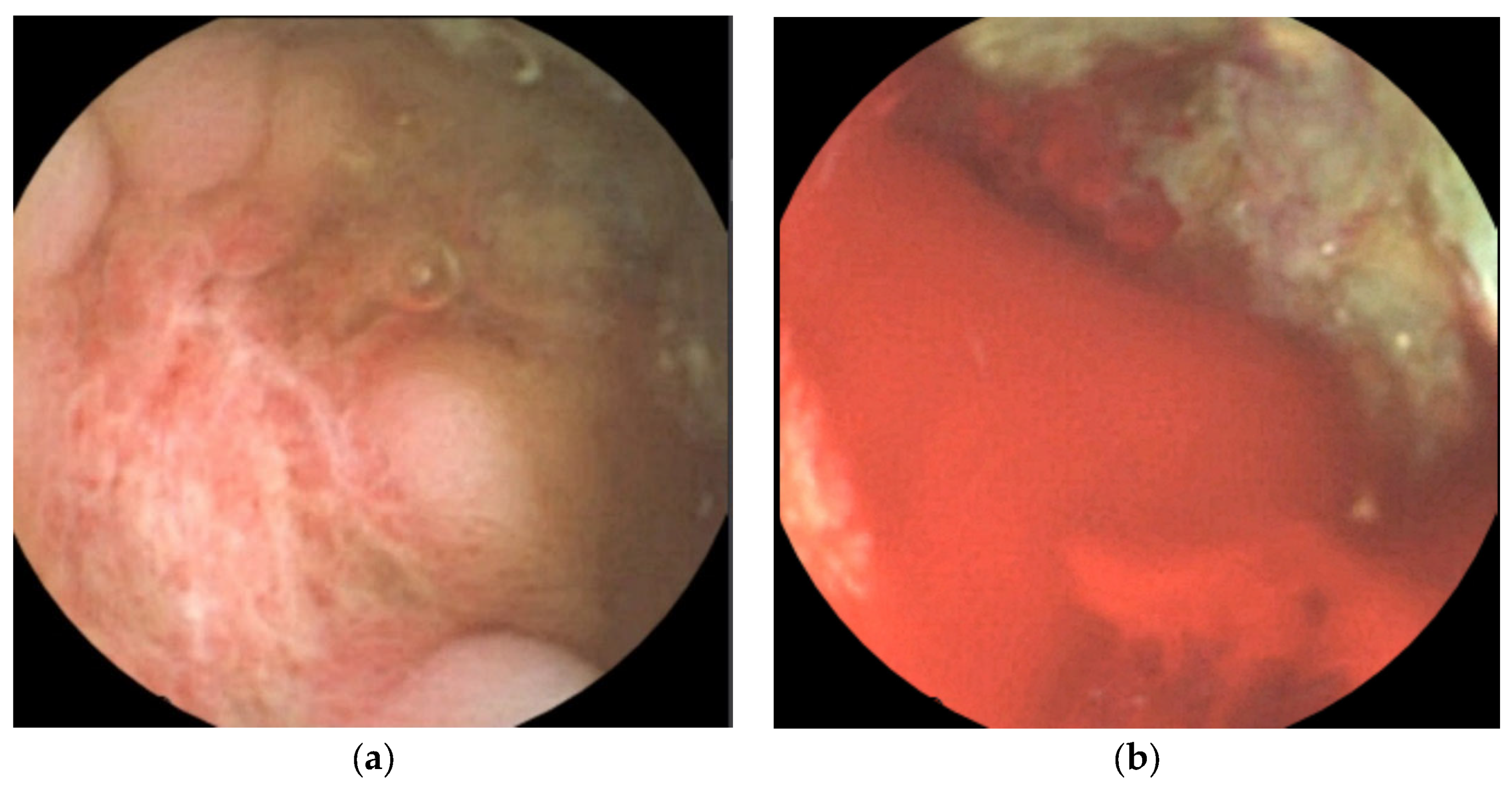 Children 09 01663 g005 Children 09 01663 g005