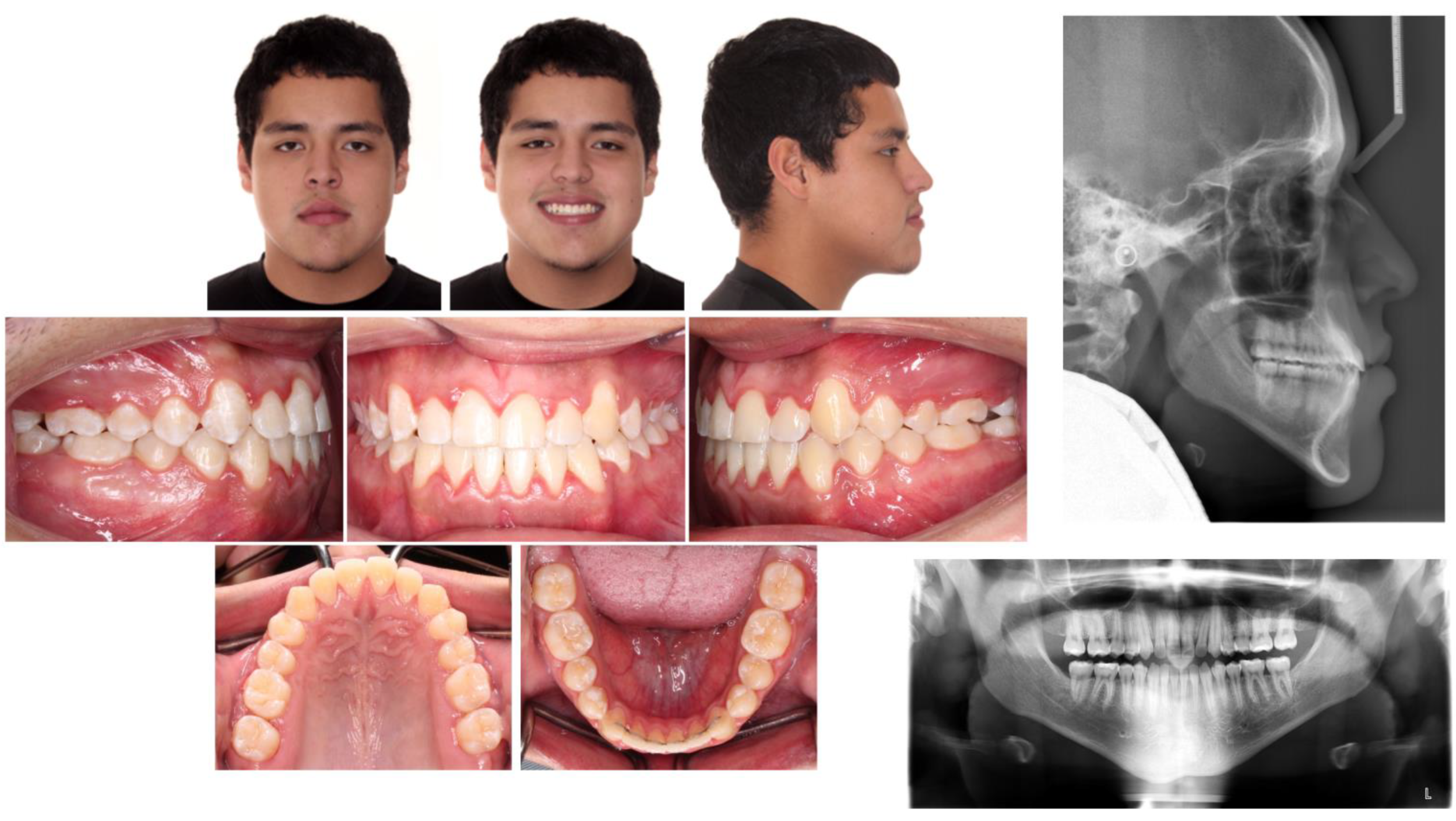 Children 09 01666 g003