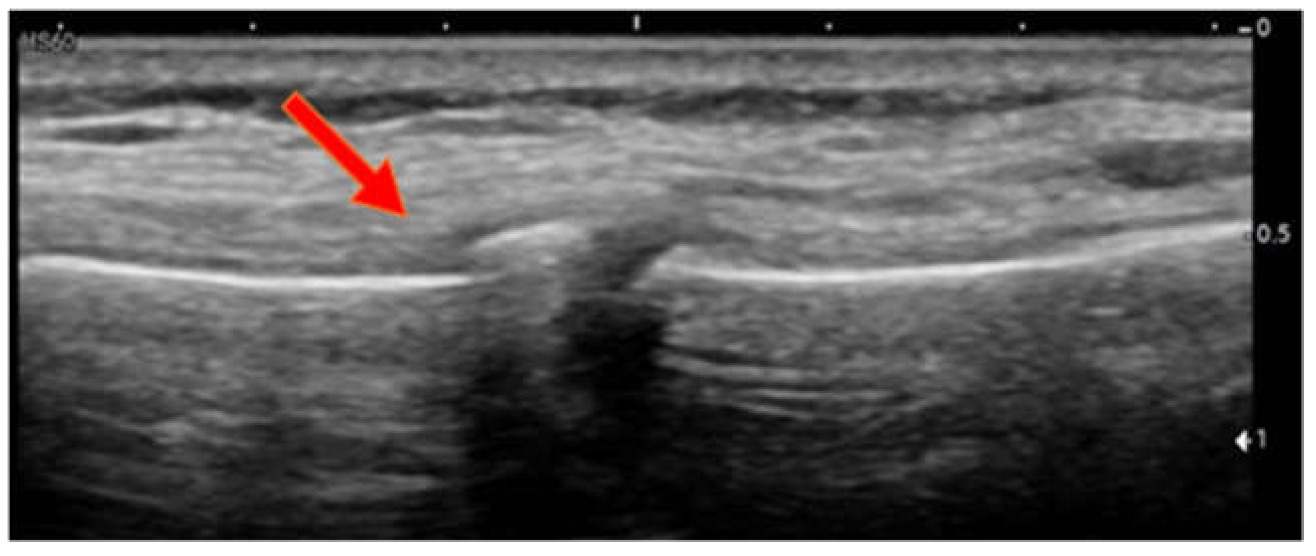 Children 09 01691 g003 Children 09 01691 g003