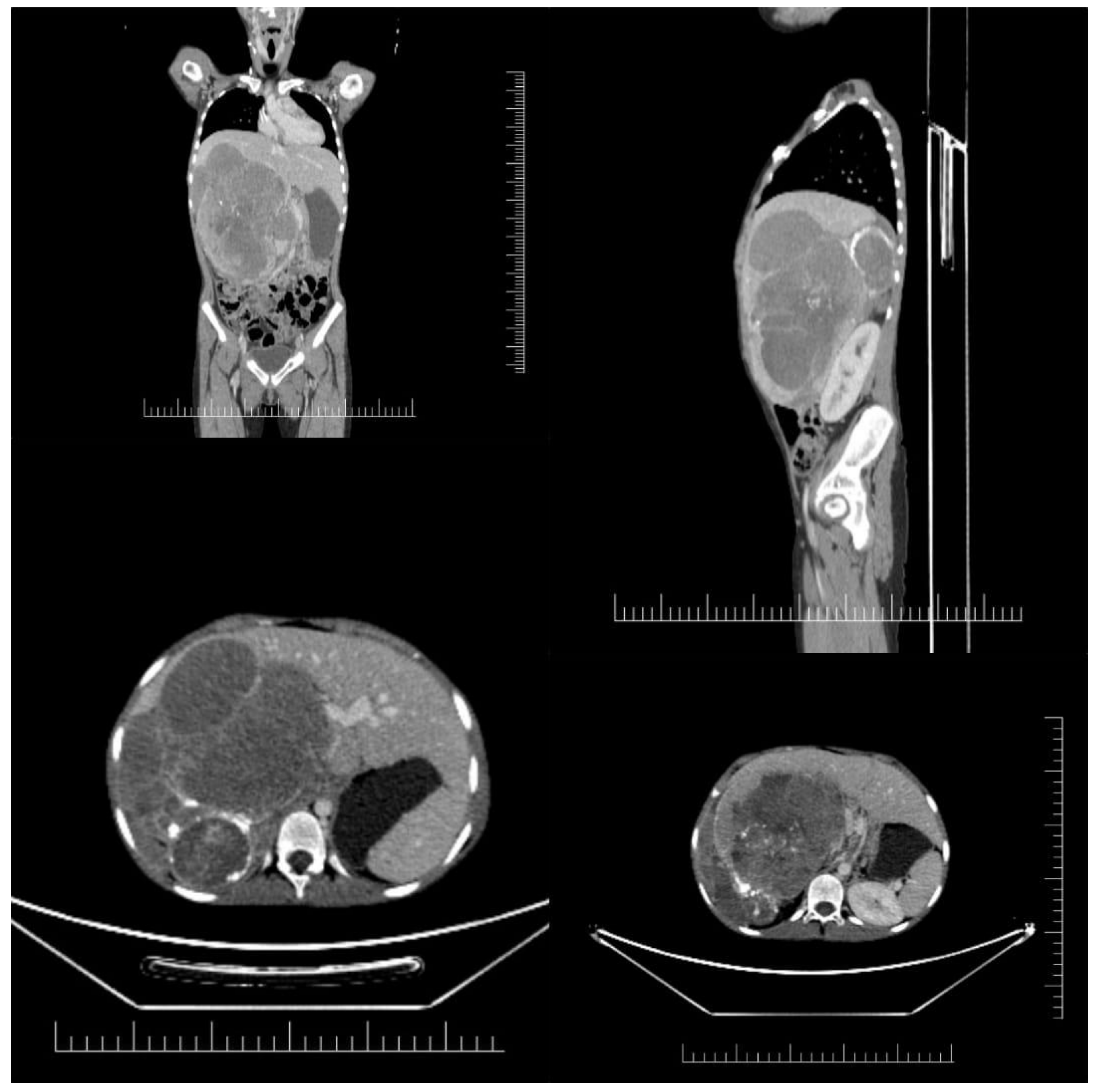 Children 09 01707 g001