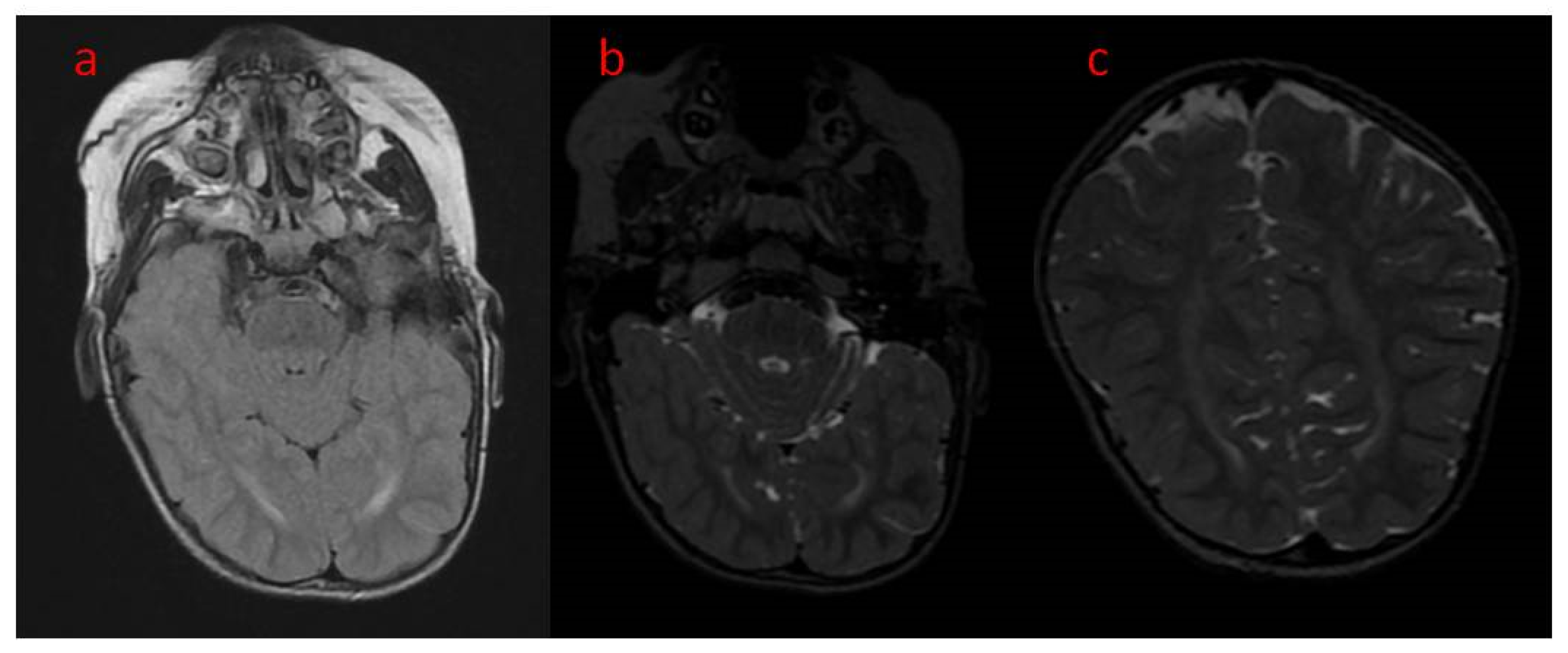 Children 09 01806 g002