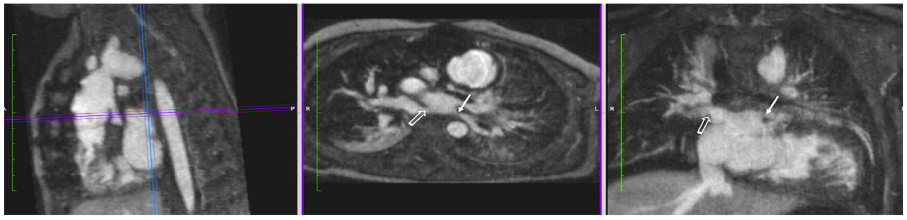 Children 09 01810 g002 Children 09 01810 g002