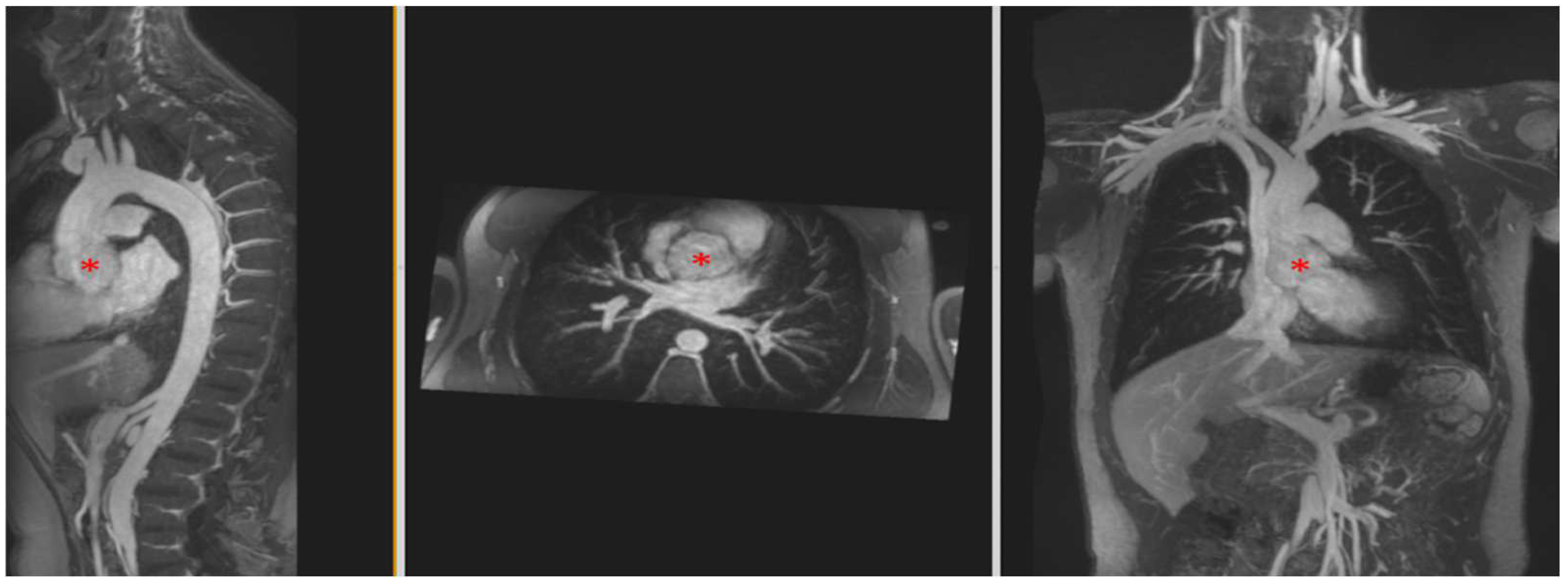 Children 09 01810 g005 Children 09 01810 g005