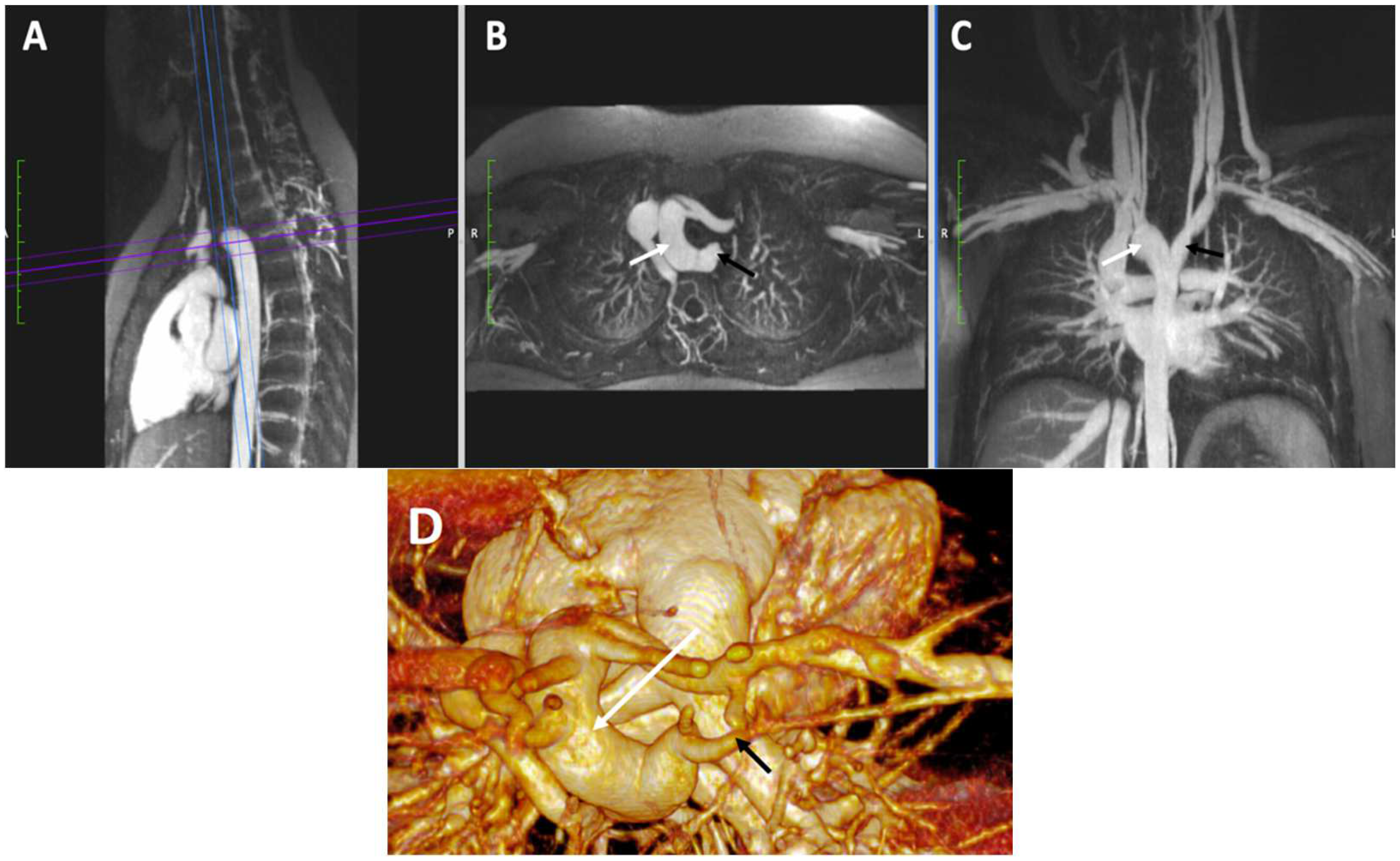 Children 09 01810 g006 Children 09 01810 g006