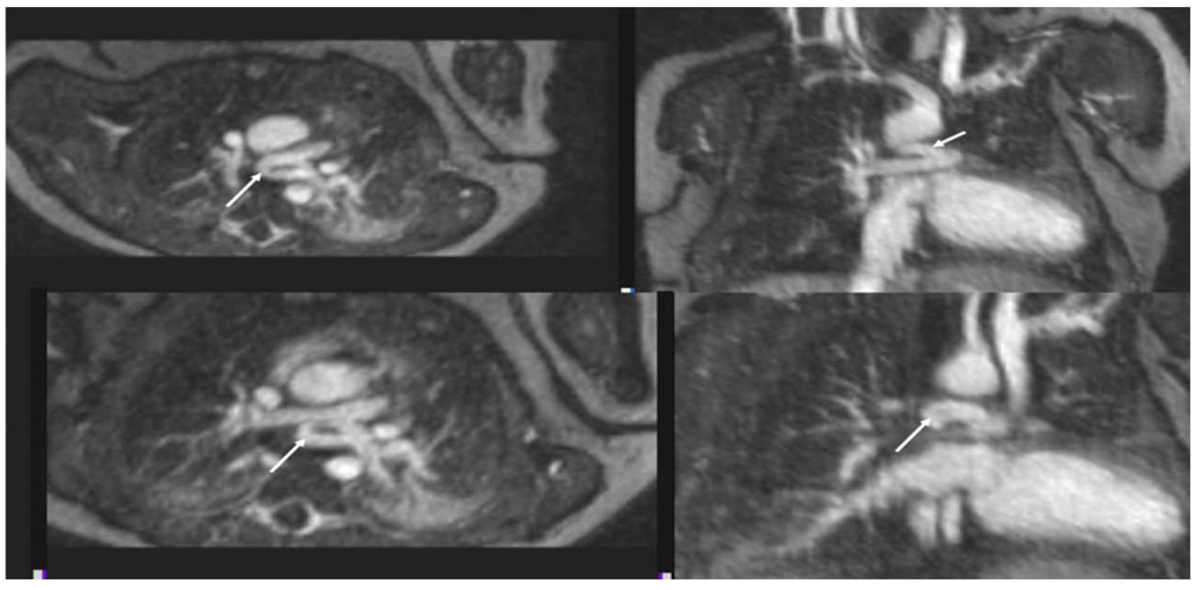 Children 09 01810 g007 Children 09 01810 g007