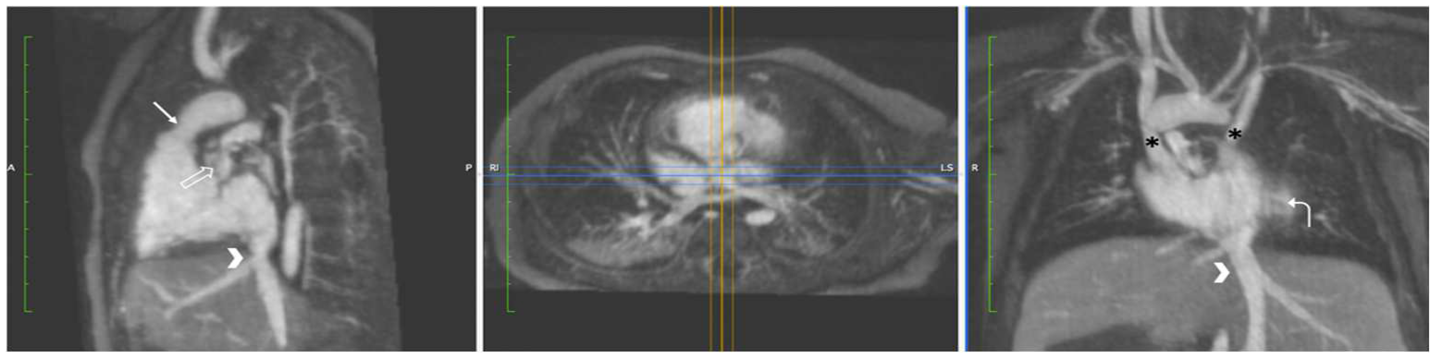 Children 09 01810 g008 Children 09 01810 g008