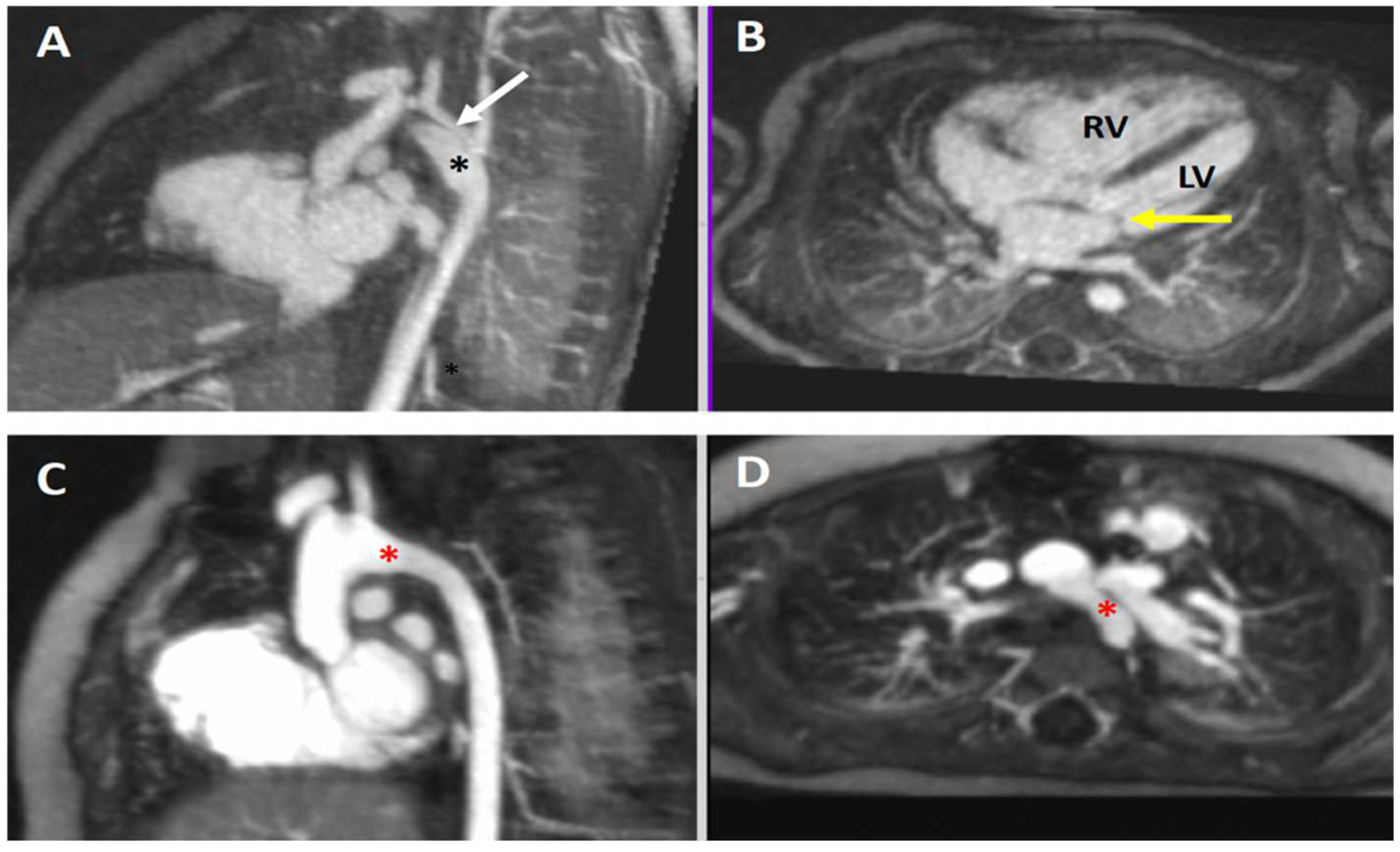 Children 09 01810 g010 Children 09 01810 g010