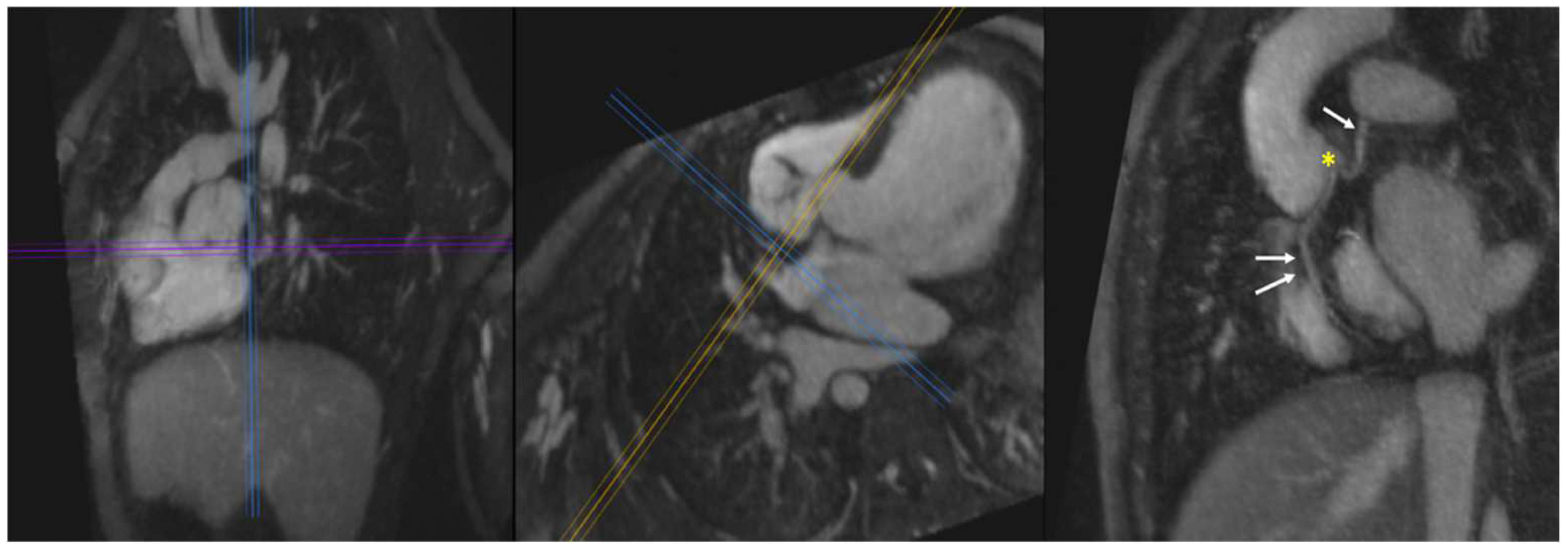 Children 09 01810 g011 Children 09 01810 g011