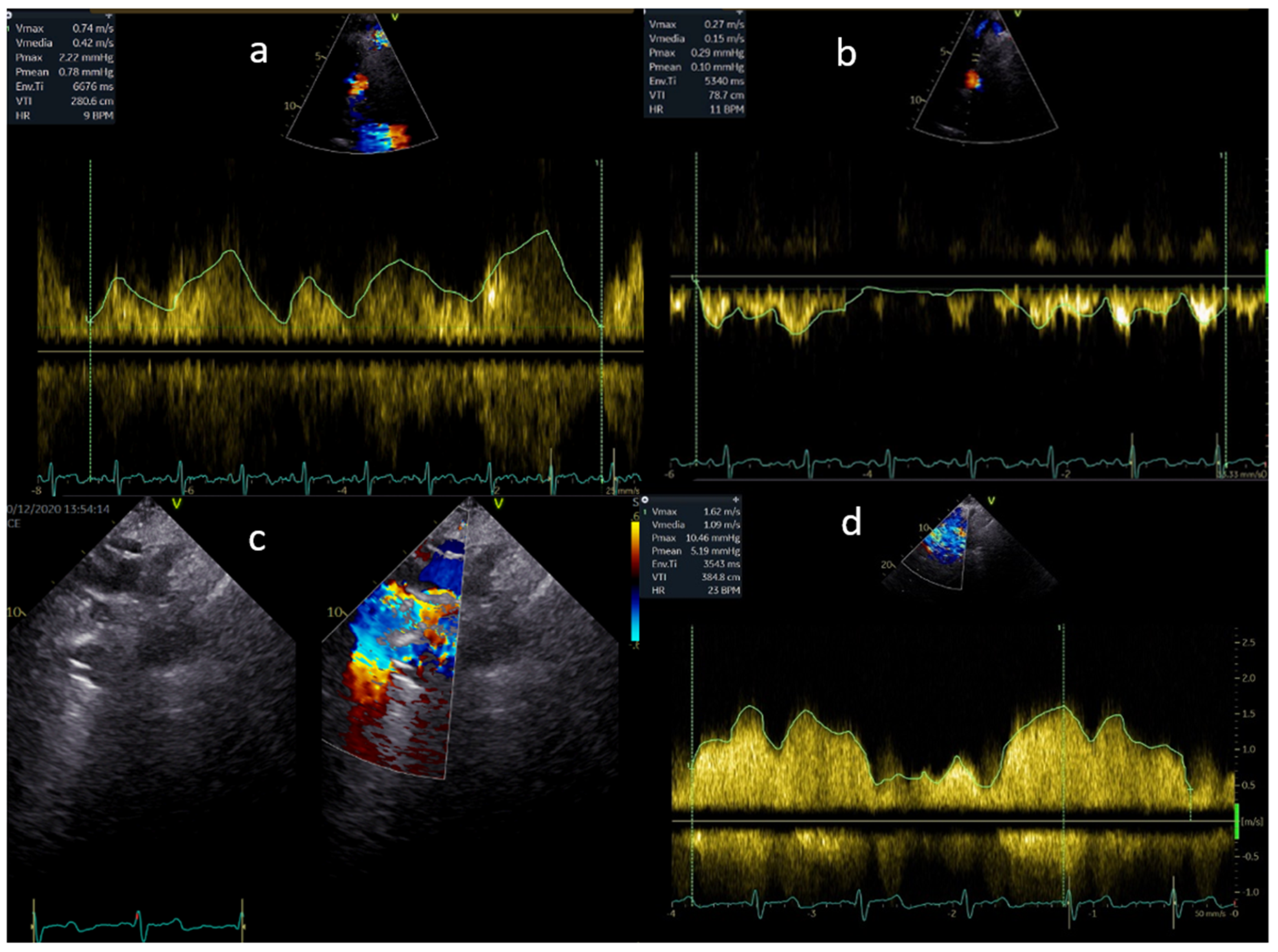 Children 09 01875 g002