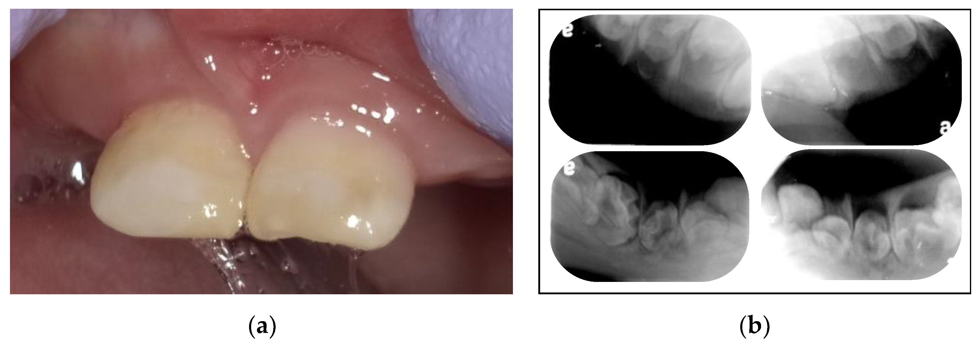 Children 09 01894 g001