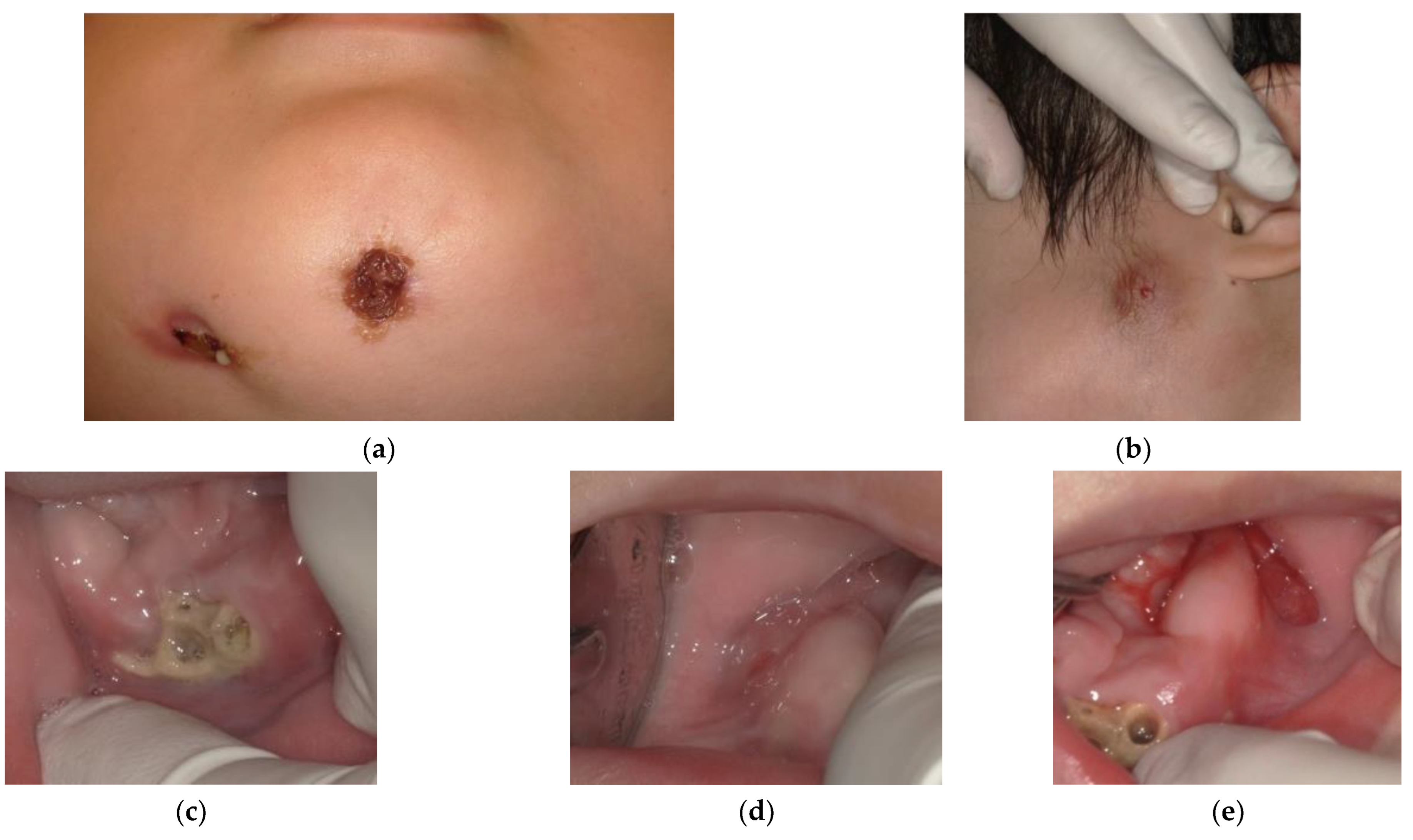 Children 09 01894 g007