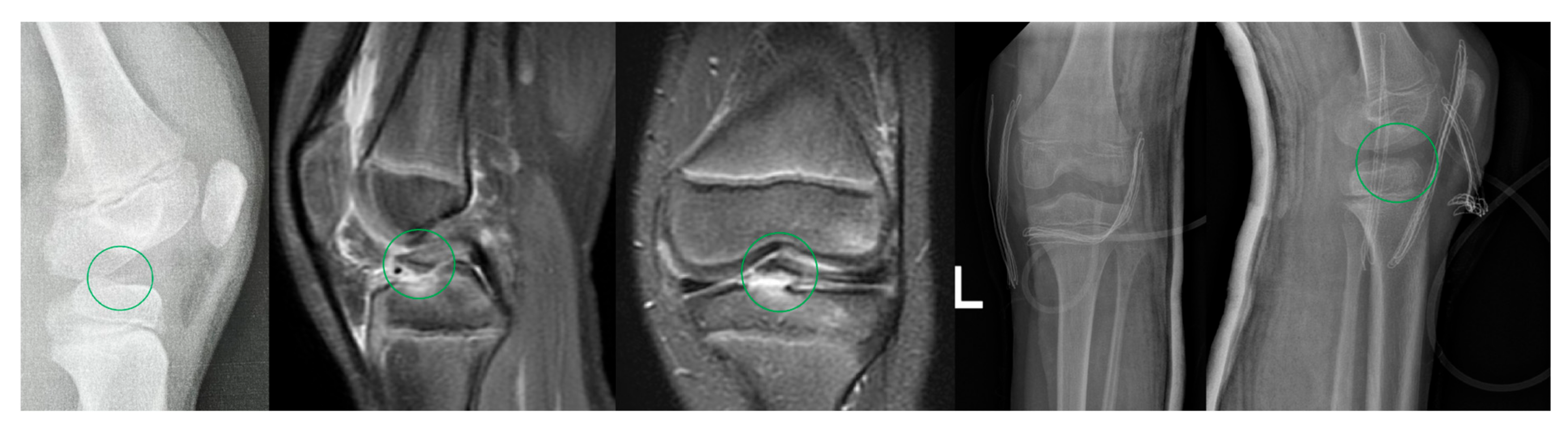 Children 09 01897 g003 Children 09 01897 g003