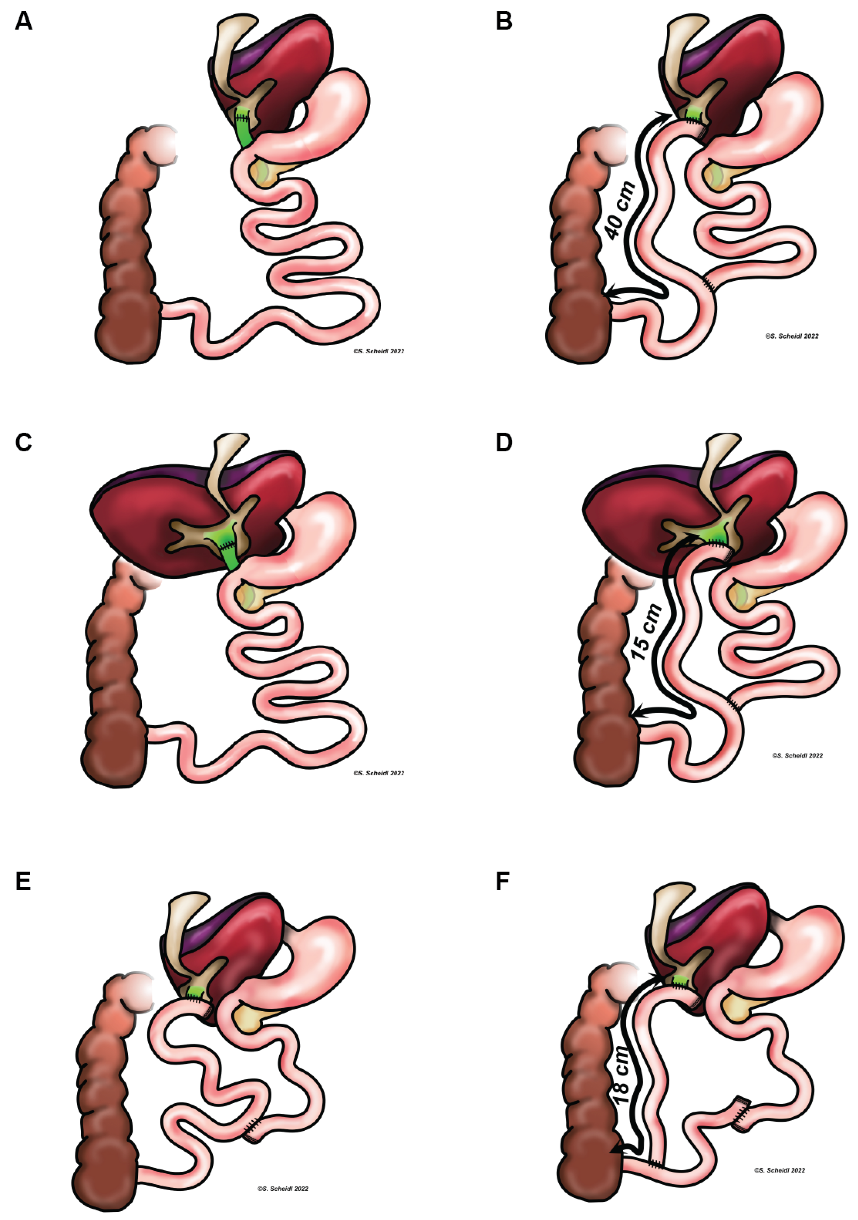 Children 09 01964 g001