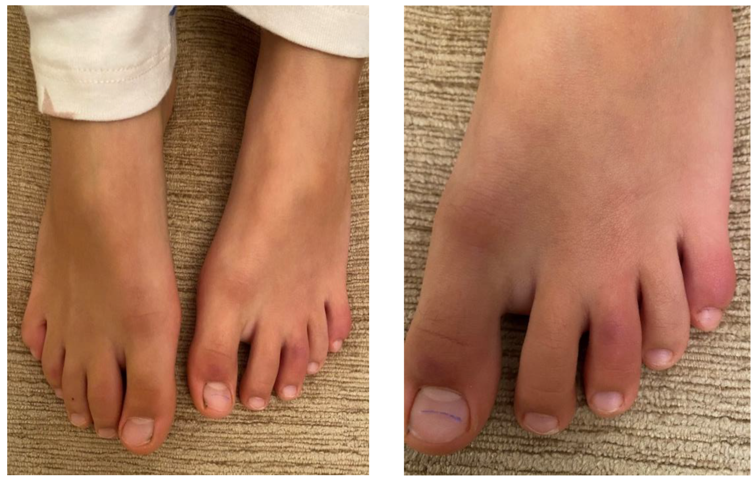 Children 09 01972 g0a2