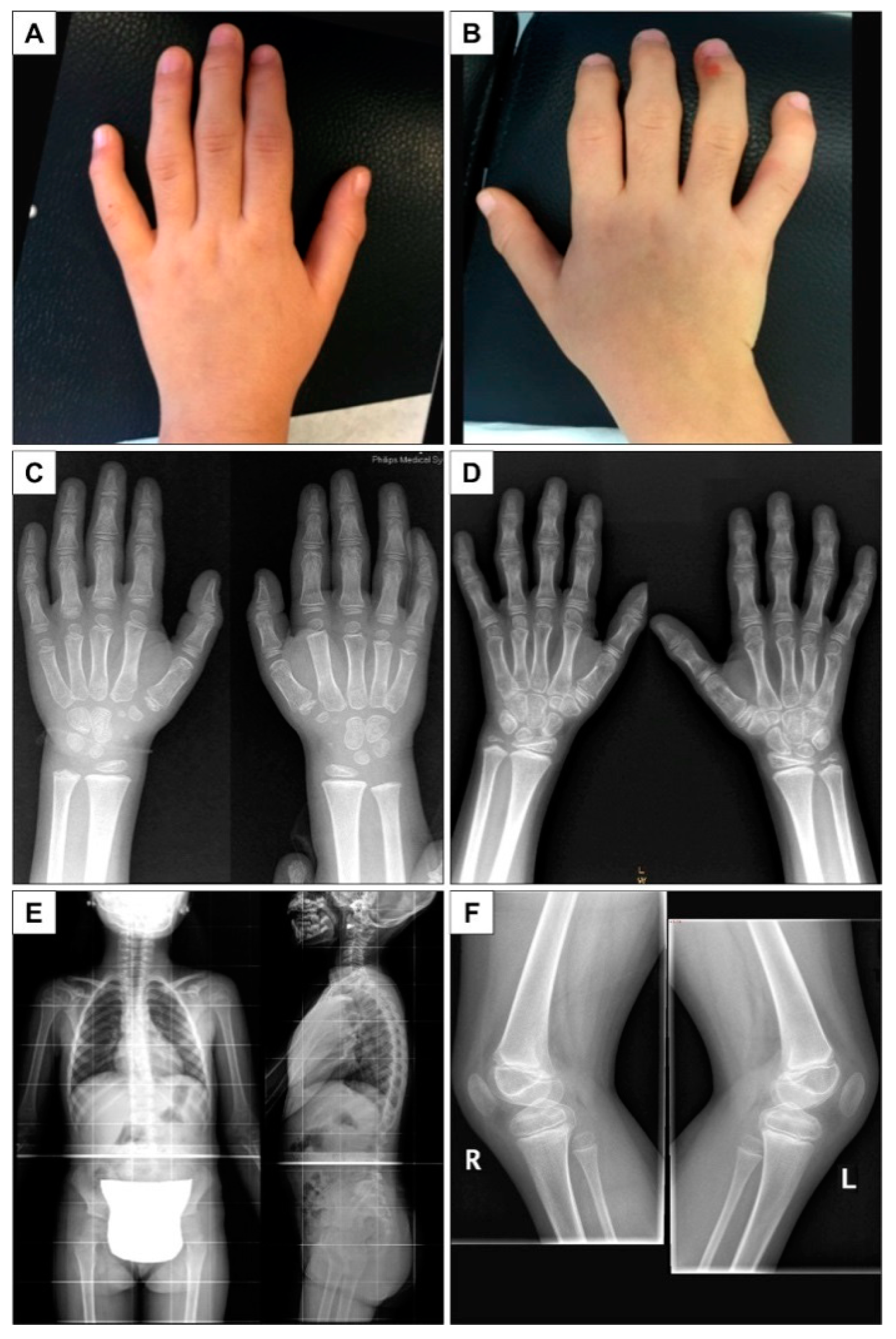 Children 09 01982 g001