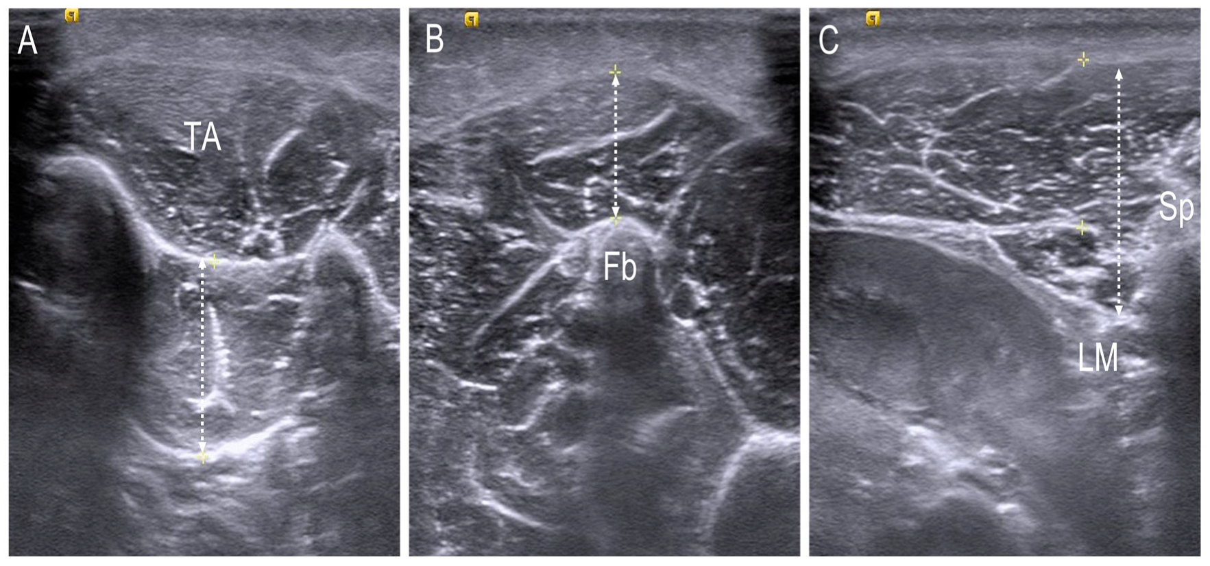 Children 10 00019 g004 Children 10 00019 g004