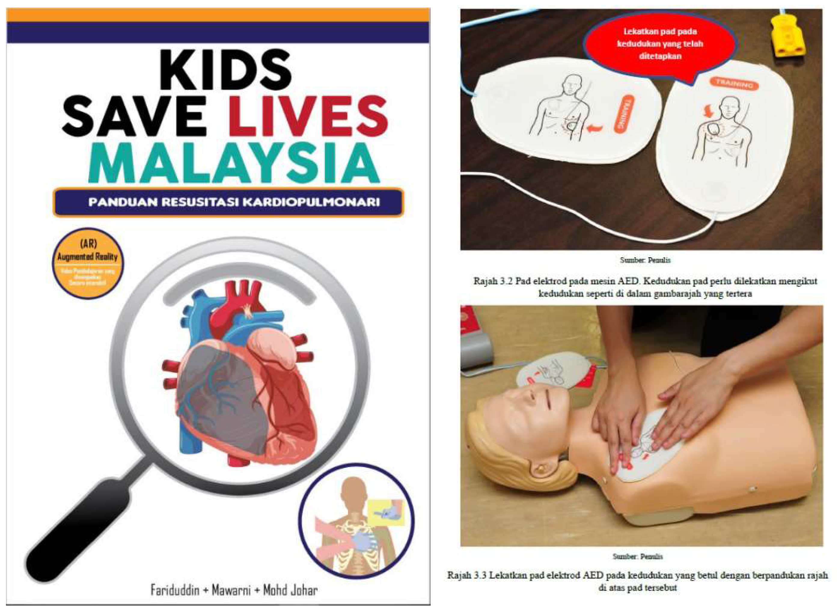 Children Free FullText CompressionOnly Cardiopulmonary Resuscitation and Automated