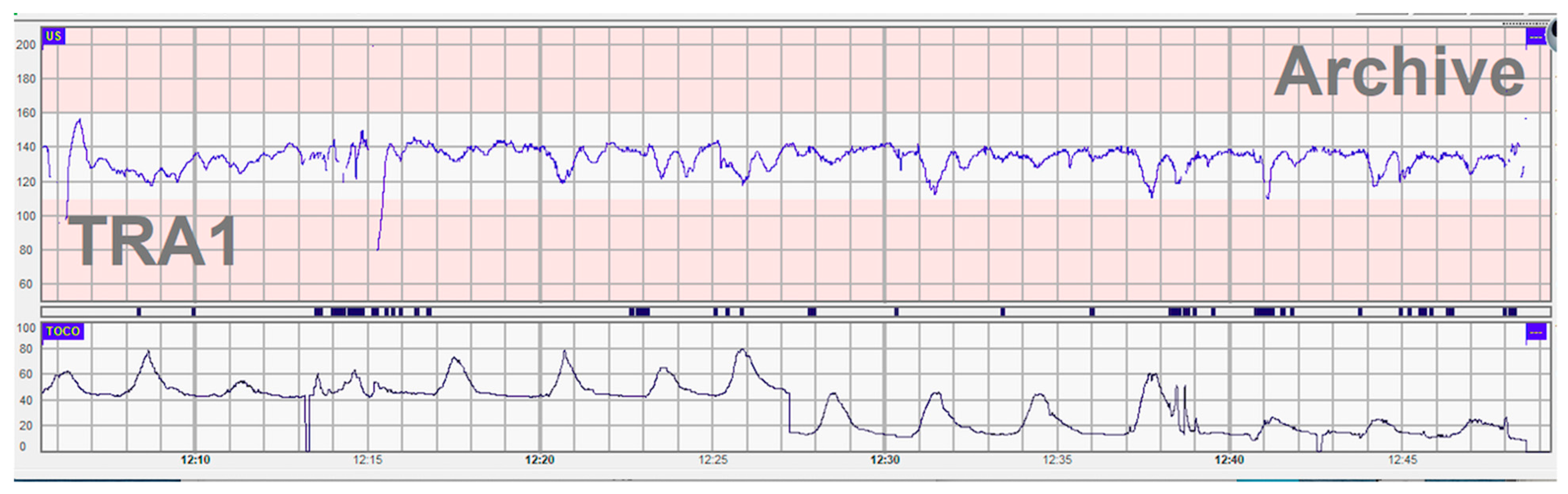 Children 10 00066 g001