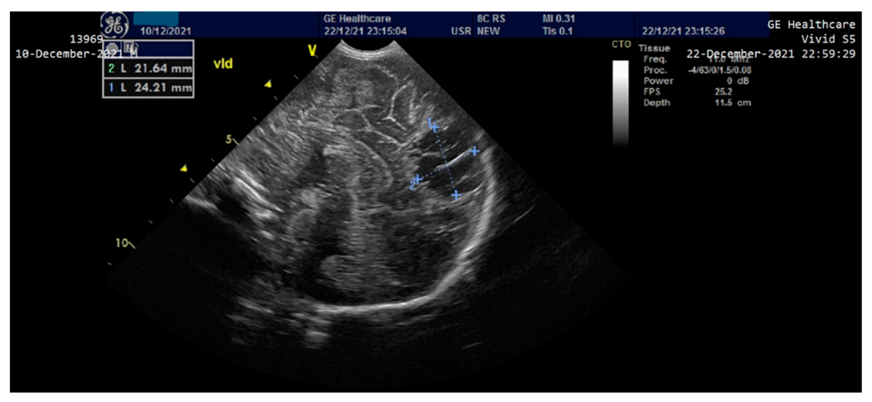 Children 10 00066 g004