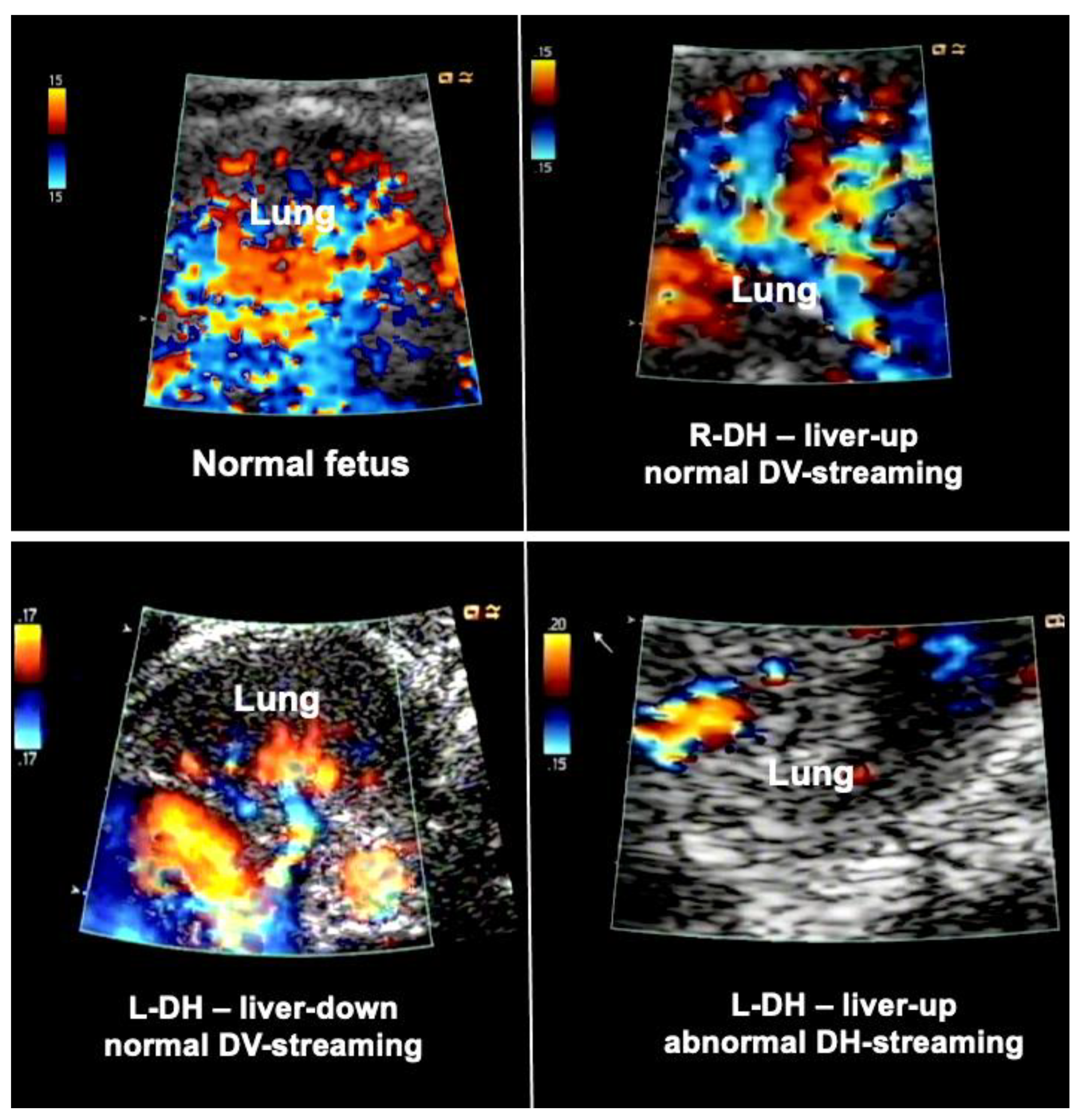 Children 10 00067 g003 Children 10 00067 g003