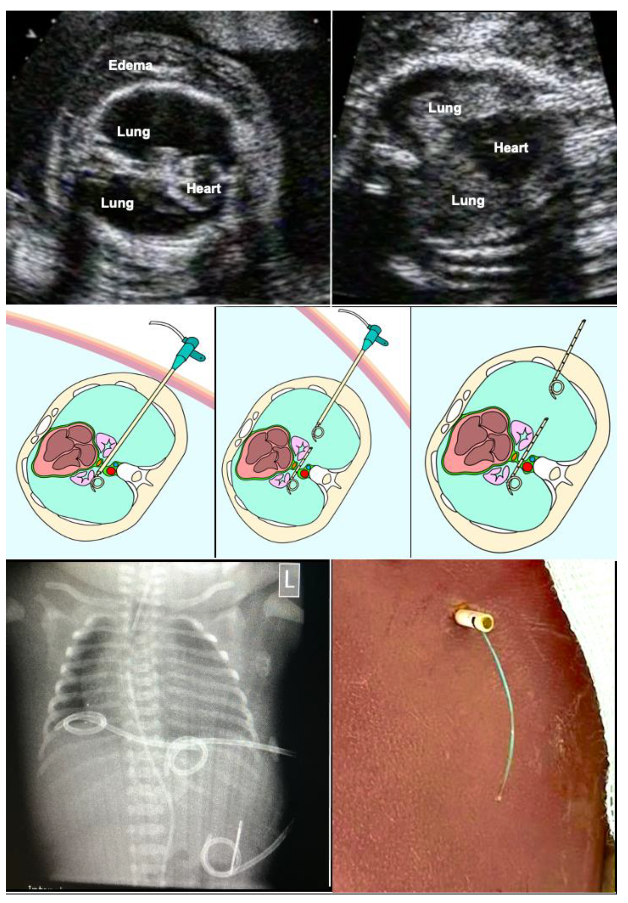 Fetology: Diagnosis and Management of the Fetal Patient by