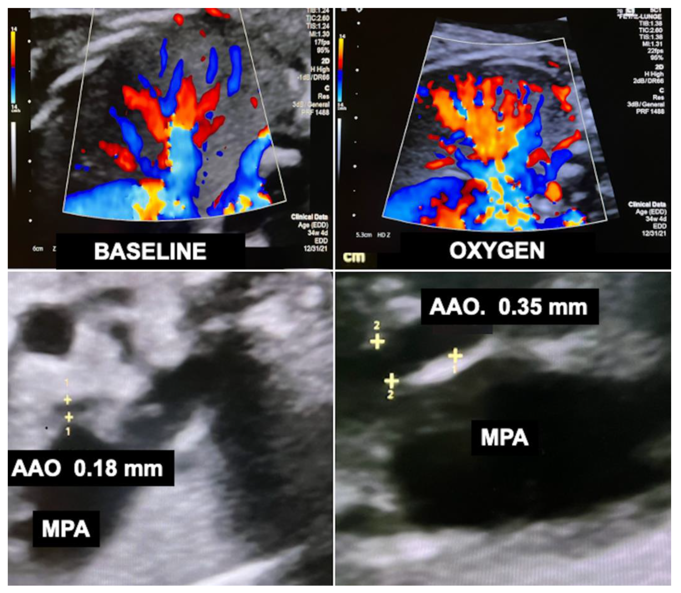 Children 10 00067 g012 Children 10 00067 g012