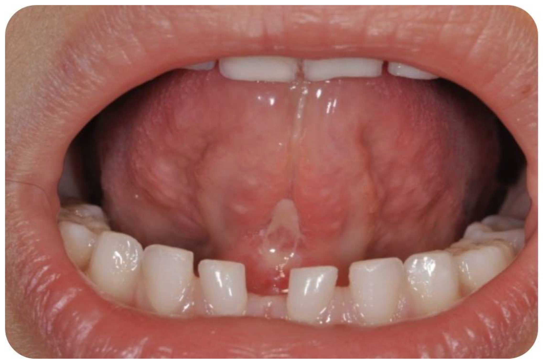 Children 10 00105 g004 Children 10 00105 g004