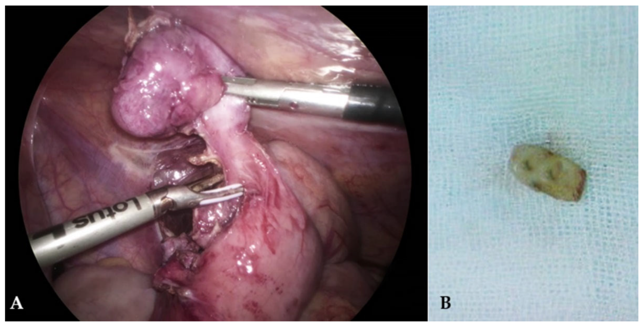 Children 10 00108 g002 Children 10 00108 g002