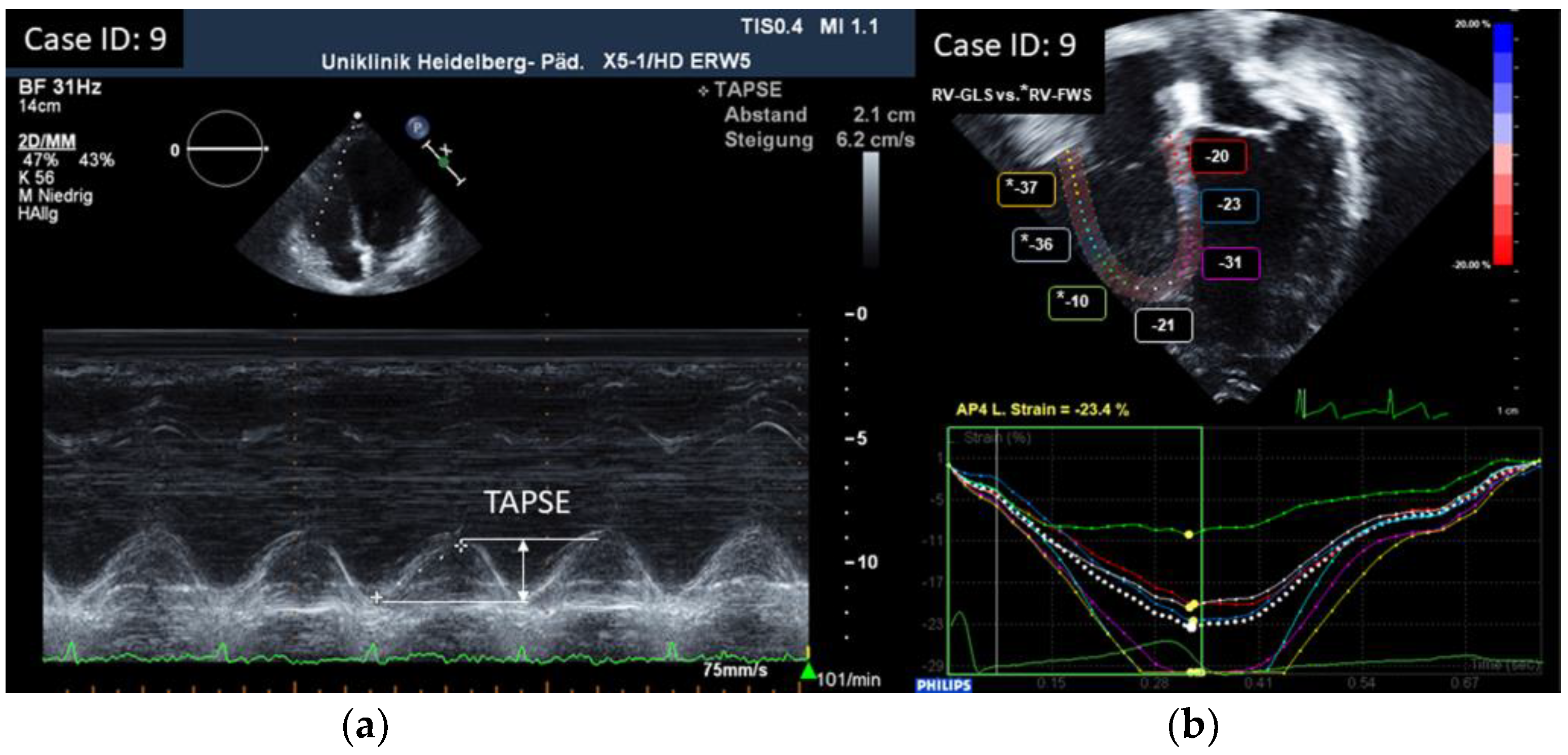 Children 10 00113 g001 Children 10 00113 g001