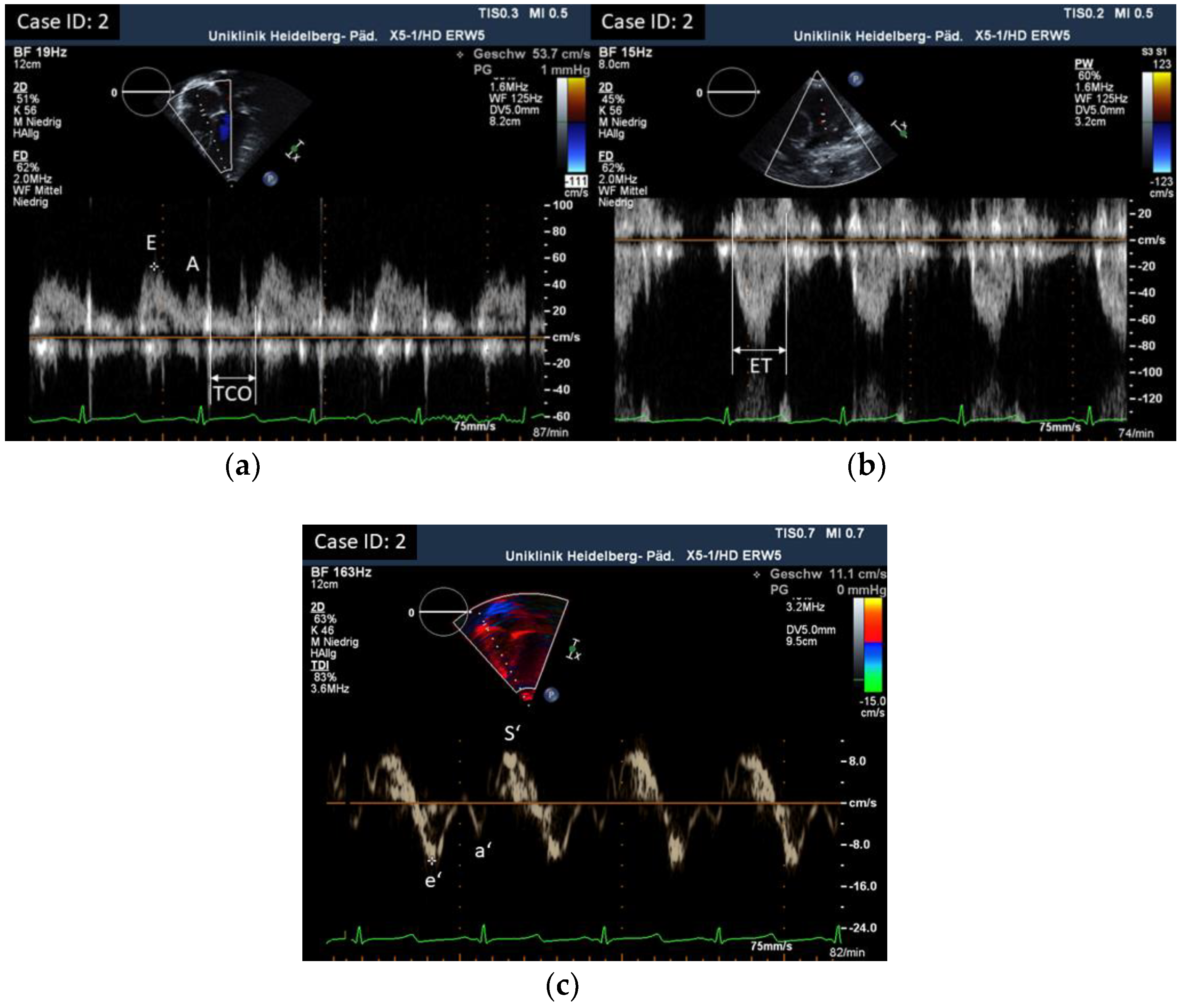 Children 10 00113 g003 Children 10 00113 g003