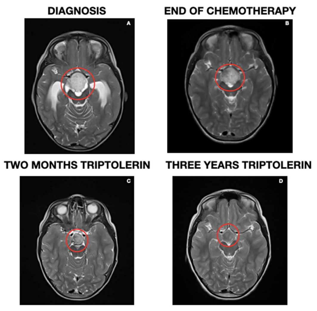Children 10 00115 g004