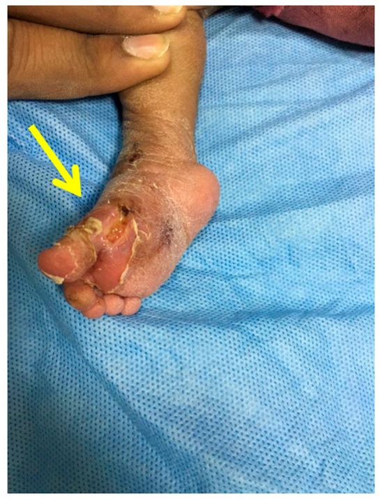 Children 10 00152 g004