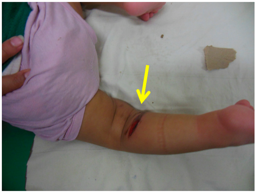 Children 10 00152 g005