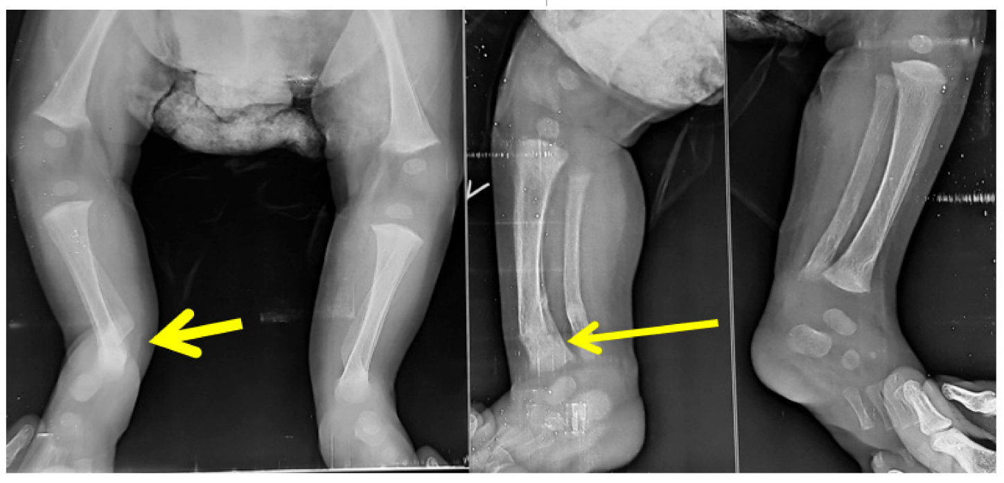 Children 10 00152 g006