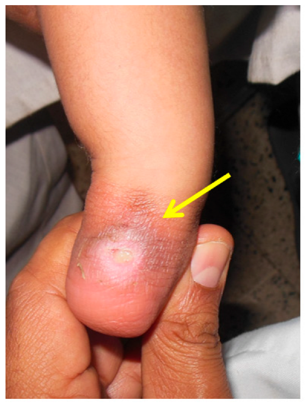 Children 10 00152 g011