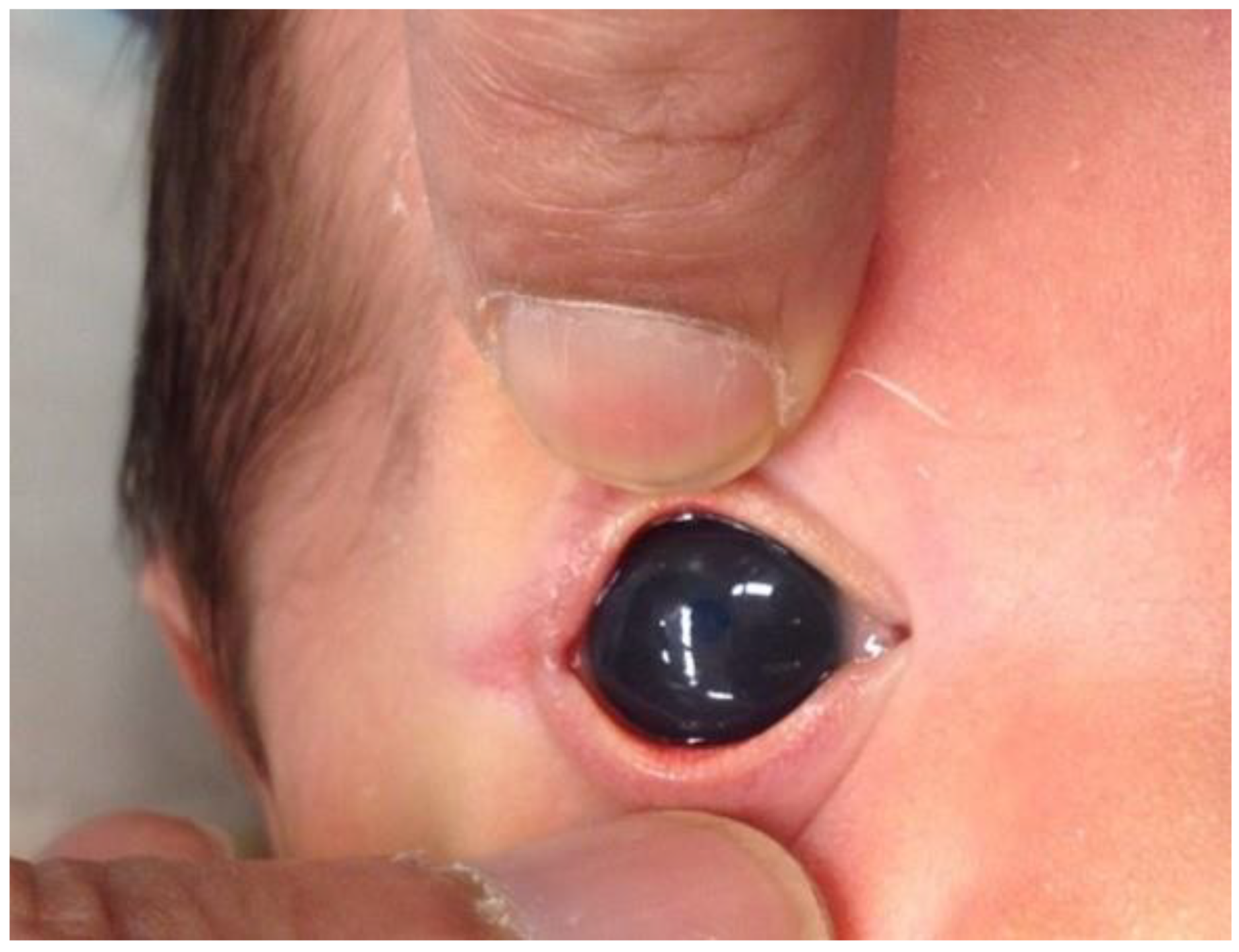 Children 10 00181 g002