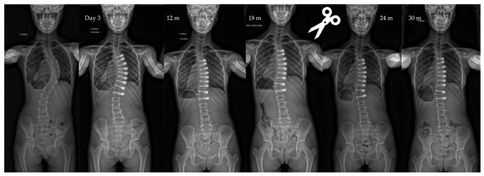 Children 10 00192 g004 Children 10 00192 g004