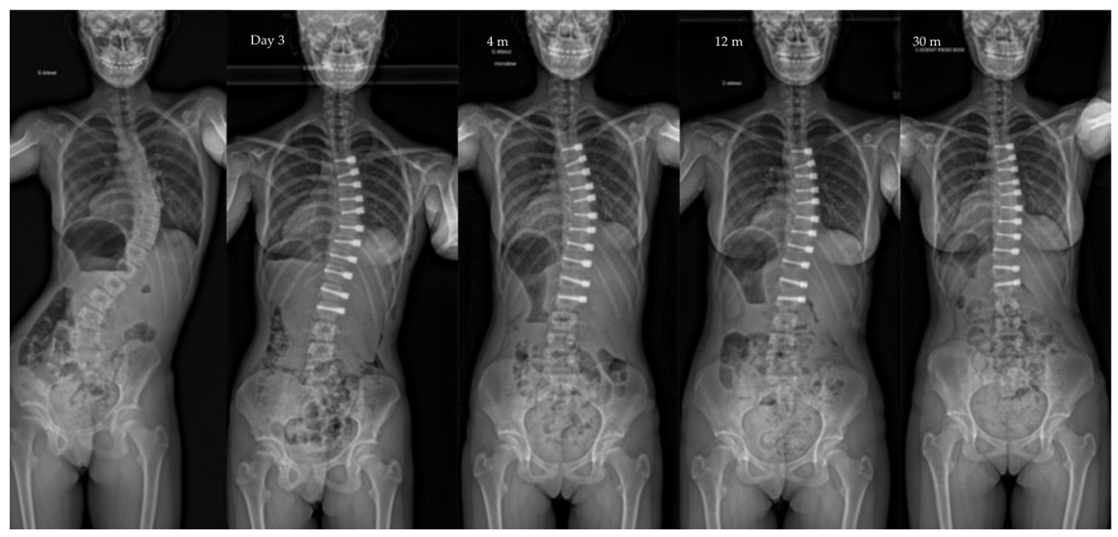 Children 10 00192 g005 Children 10 00192 g005