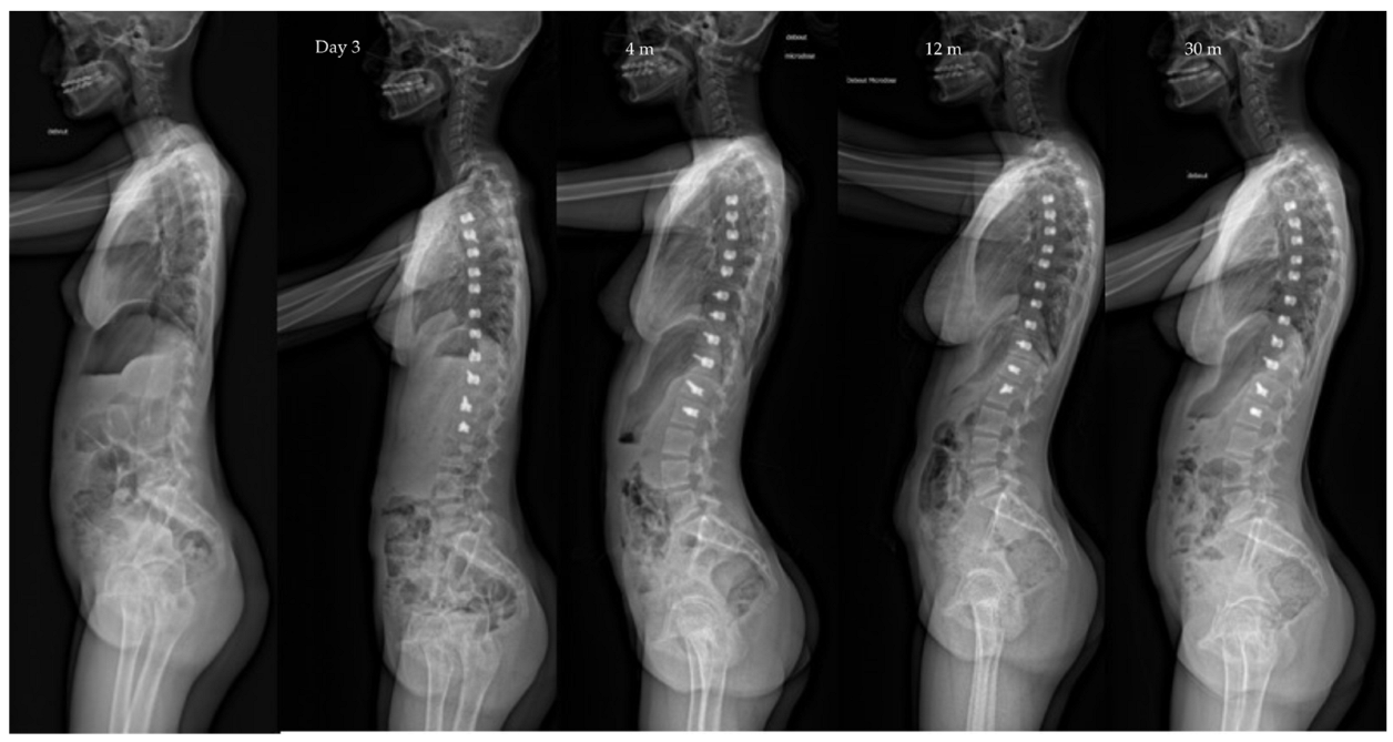 Children 10 00192 g006 Children 10 00192 g006