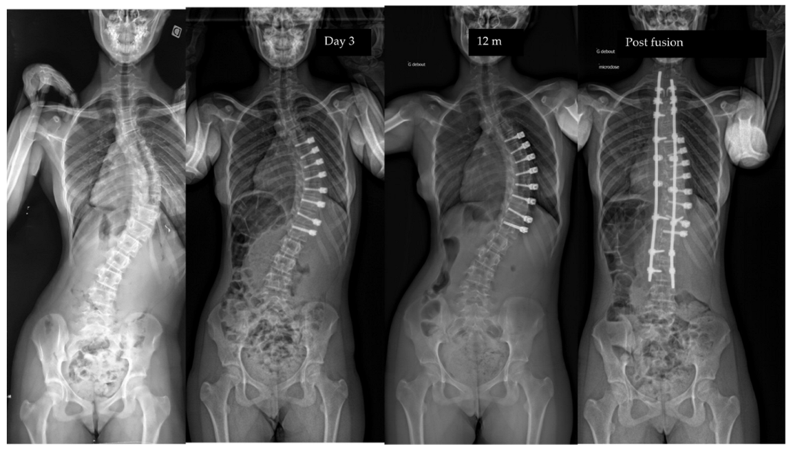 Children 10 00192 g007 Children 10 00192 g007