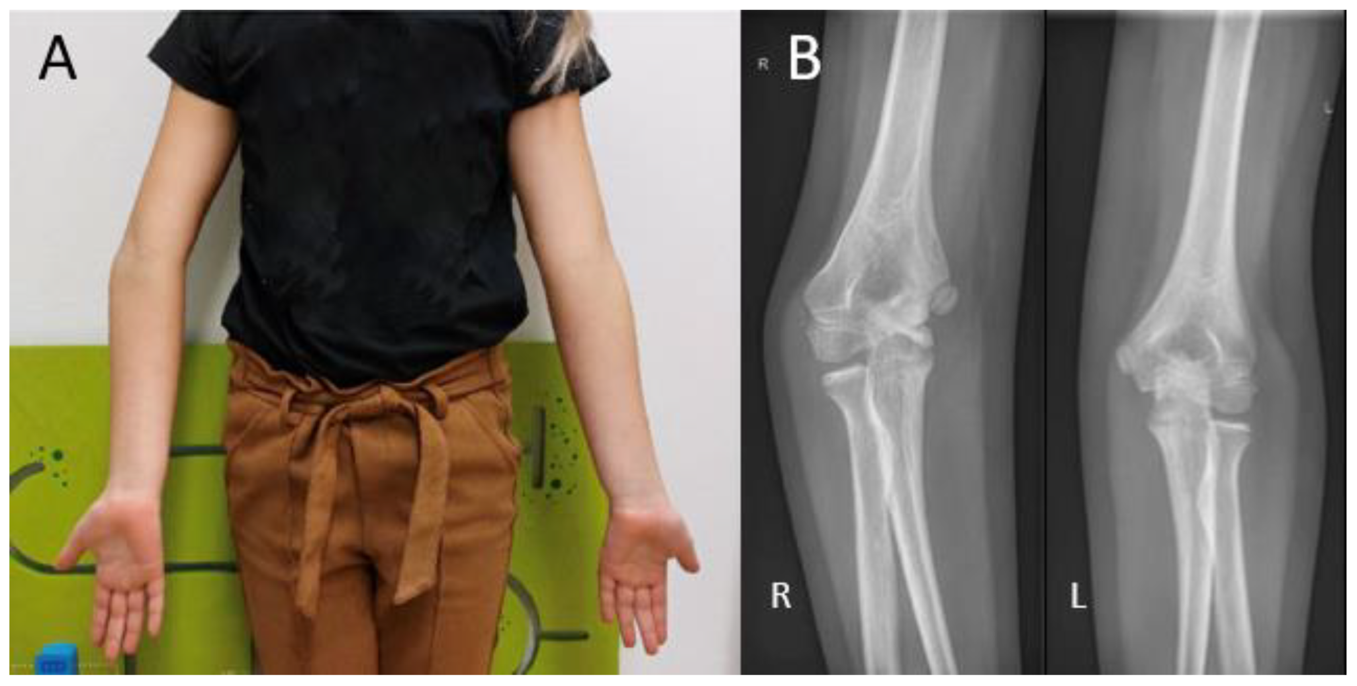 Children 10 00195 g001