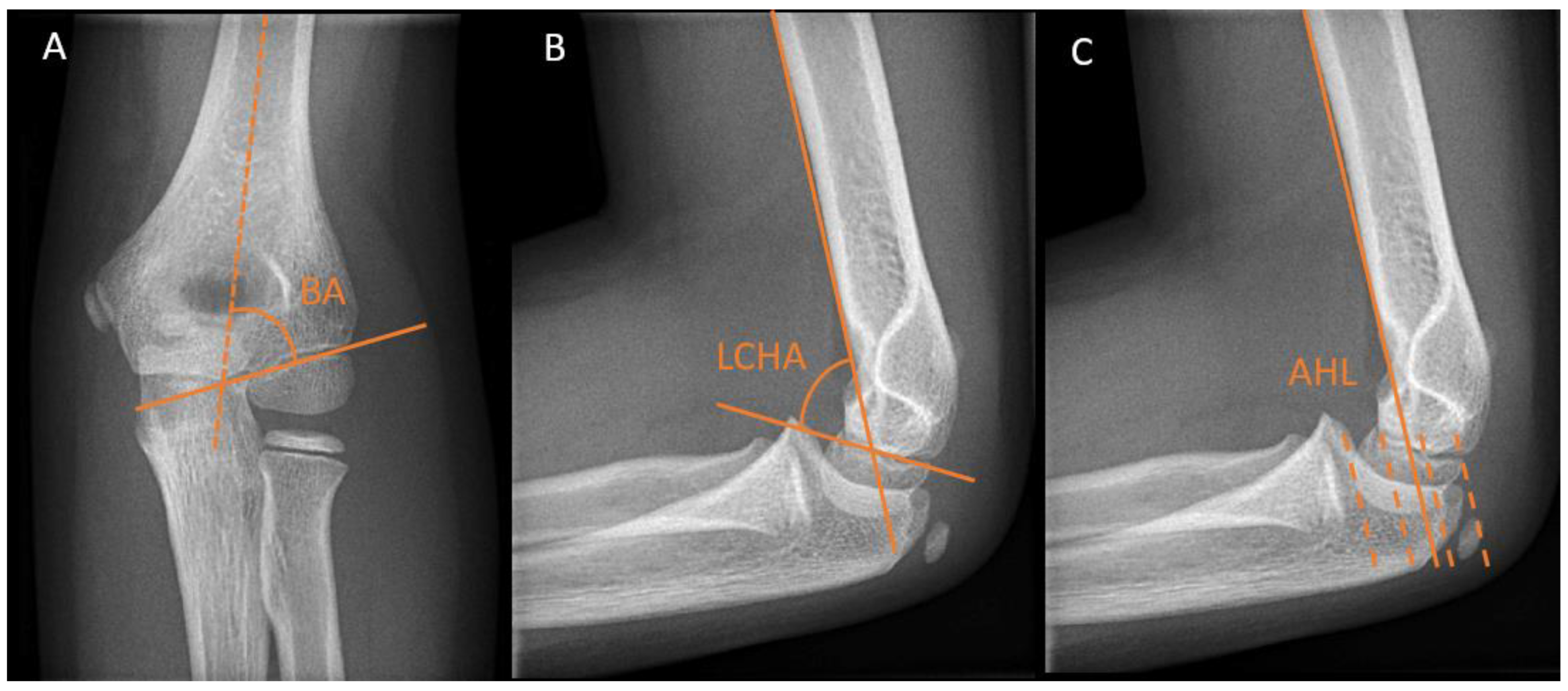 Children 10 00195 g002