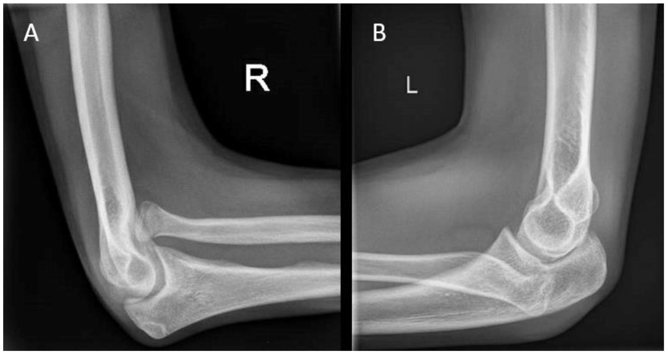 Children 10 00195 g005