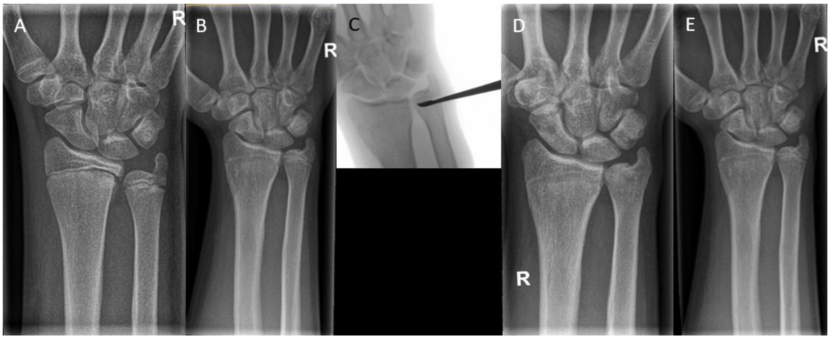 Children 10 00195 g008