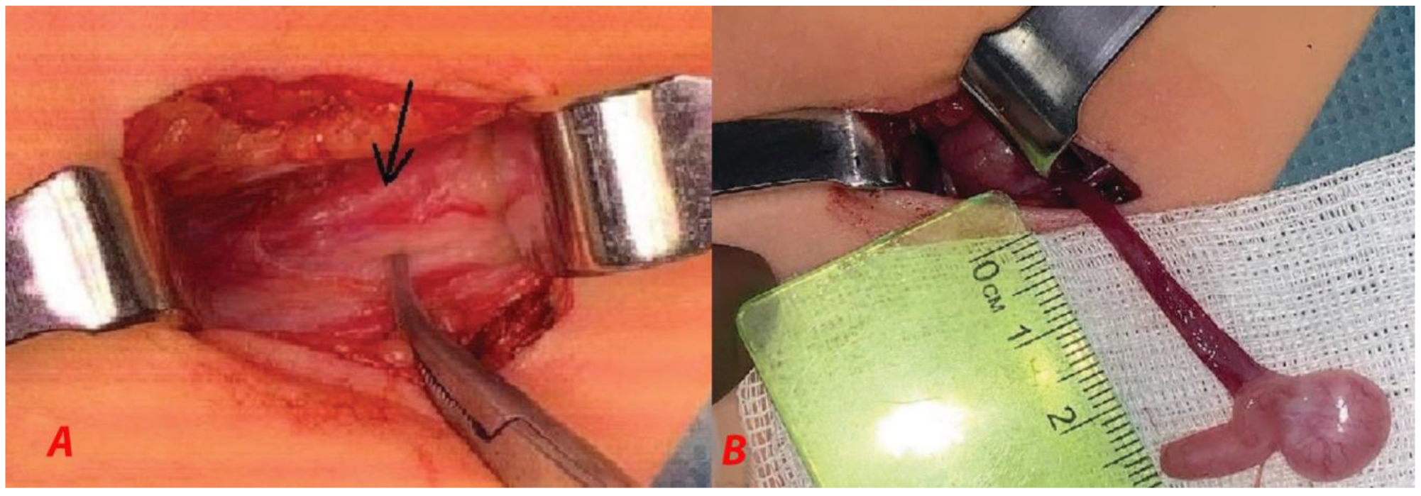 Children 10 00205 g003 Children 10 00205 g003