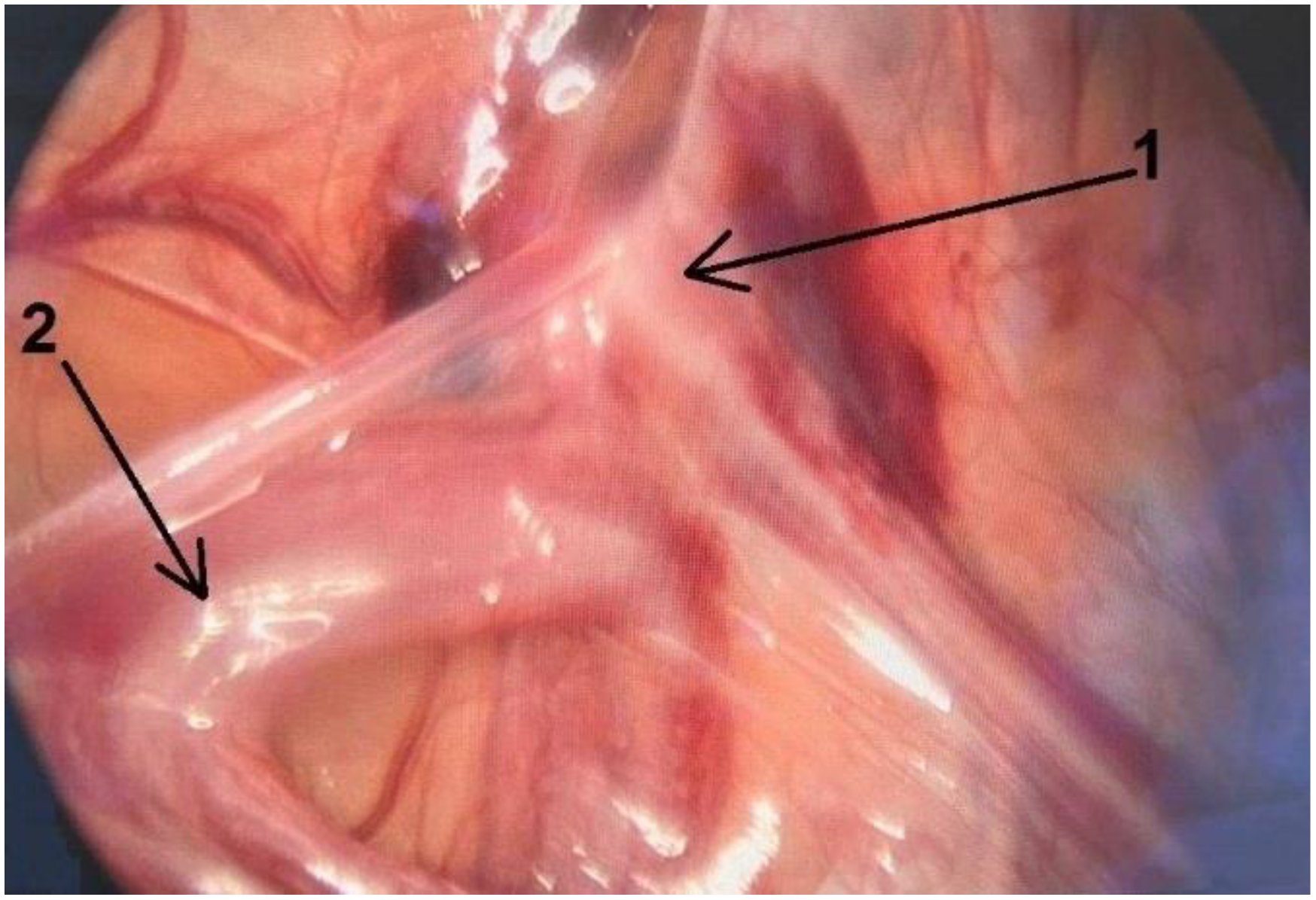 Children 10 00205 g005 Children 10 00205 g005