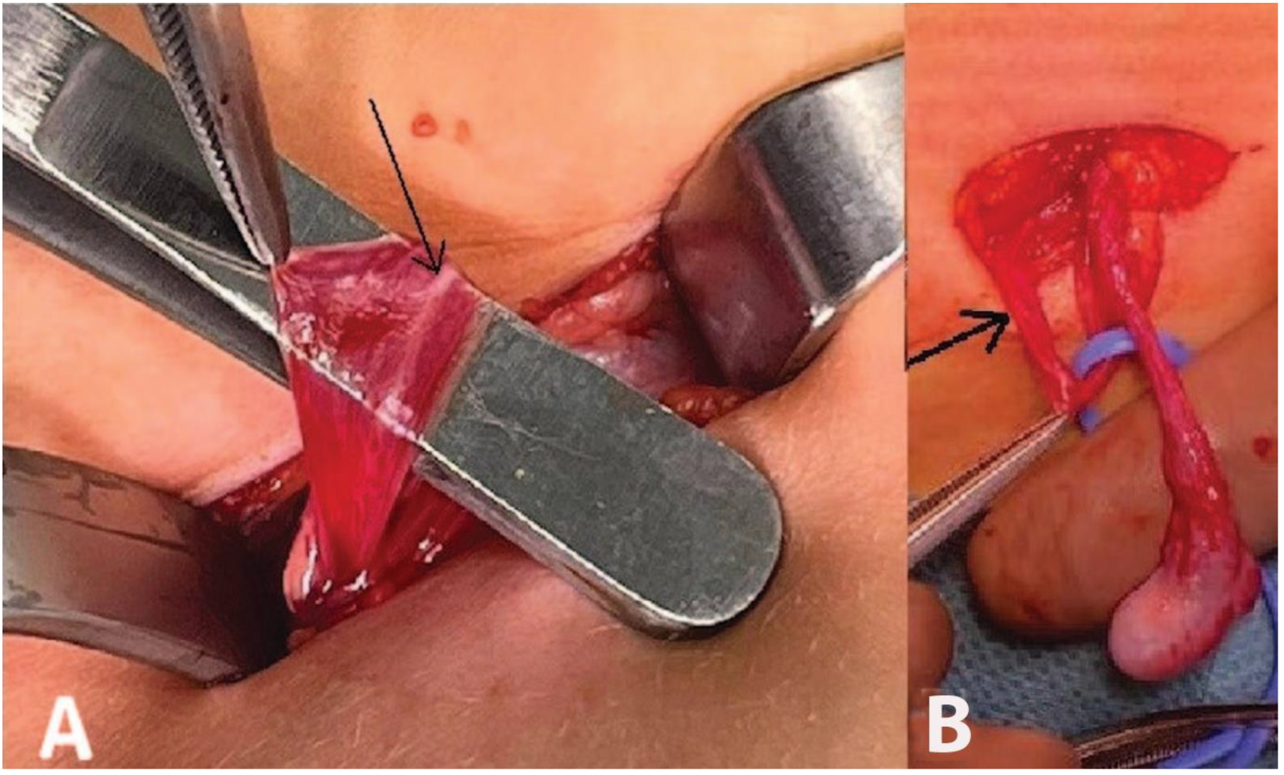 Children 10 00205 g006 Children 10 00205 g006