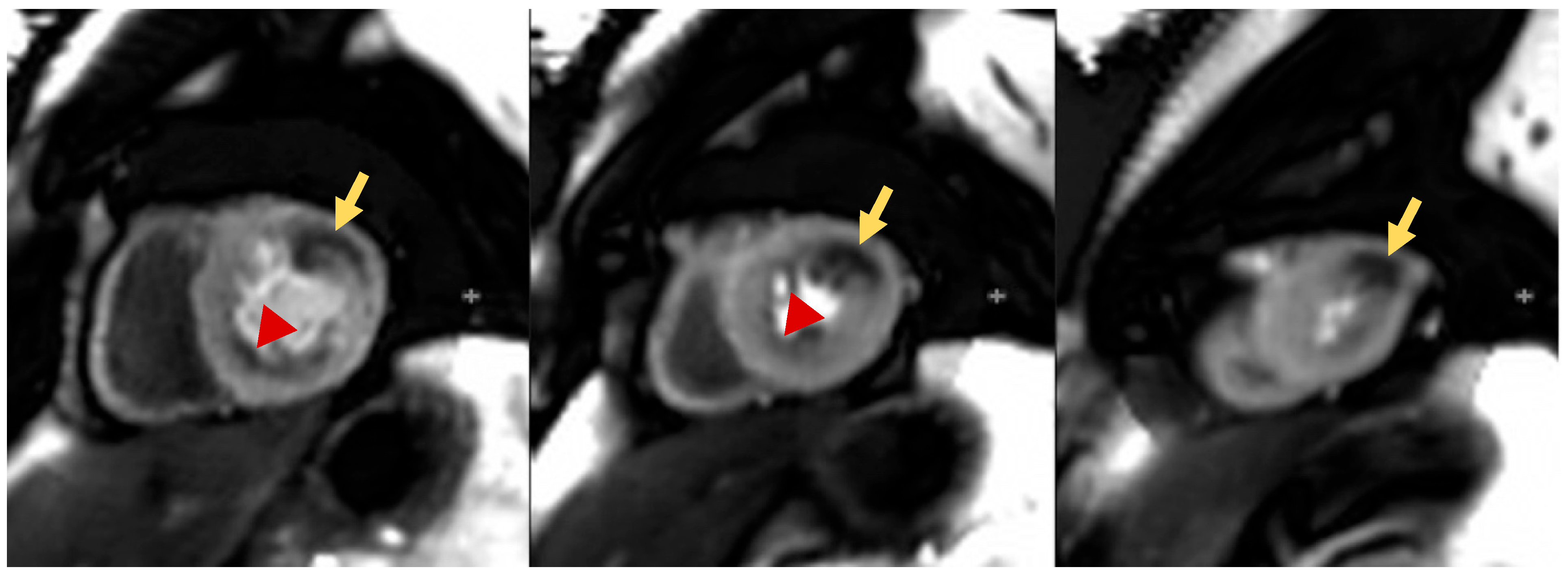 Children 10 00218 g003 Children 10 00218 g003